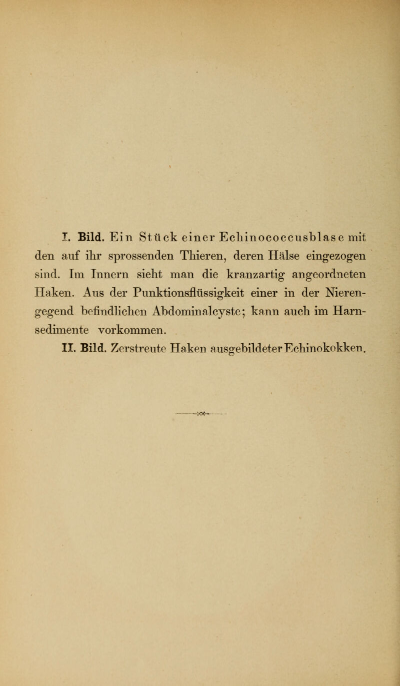 I. Bild. Ein Stück einer Ecliinococcnsblase mit den auf ihr sprossenden Thieren, deren Hälse eingezogen sind. Im Innern sieht man die kränz artig angeordneten Haken. Aus der Punktionsflüssigkeit einer in der Nieren- gegend befindlichen Abdominalcyste; kann auch im Harn- sedimente vorkommen. II. Bild. Zerstreute Haken ausgebildeter Echinokokken. -',0«-^