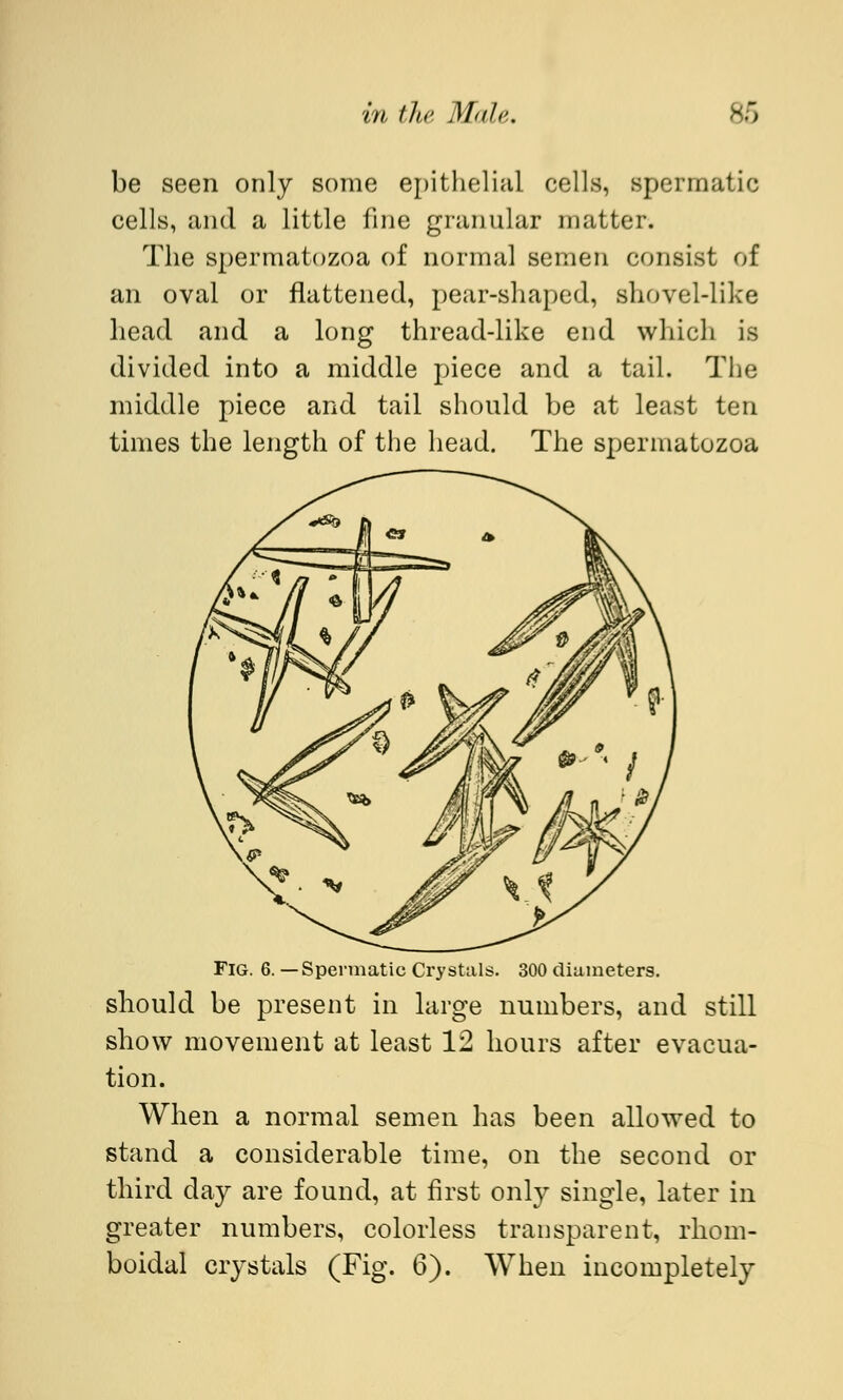 be seen only some epithelial cells, spermatic cells, and a little fine granular matter. The spermatozoa of normal semen consist of an oval or flattened, pear-shaped, shovel-like head and a long thread-like end which is divided into a middle piece and a tail. The middle piece and tail should be at least ten times the length of the head. The spermatozoa Fig. 6. —Spermatic Crystals. 300 diameters. should be present in large numbers, and still show movement at least 12 hours after evacua- tion. When a normal semen has been allowed to stand a considerable time, on the second or third day are found, at first only single, later in greater numbers, colorless transparent, rhom- boidal crystals (Fig. 6). When incompletely