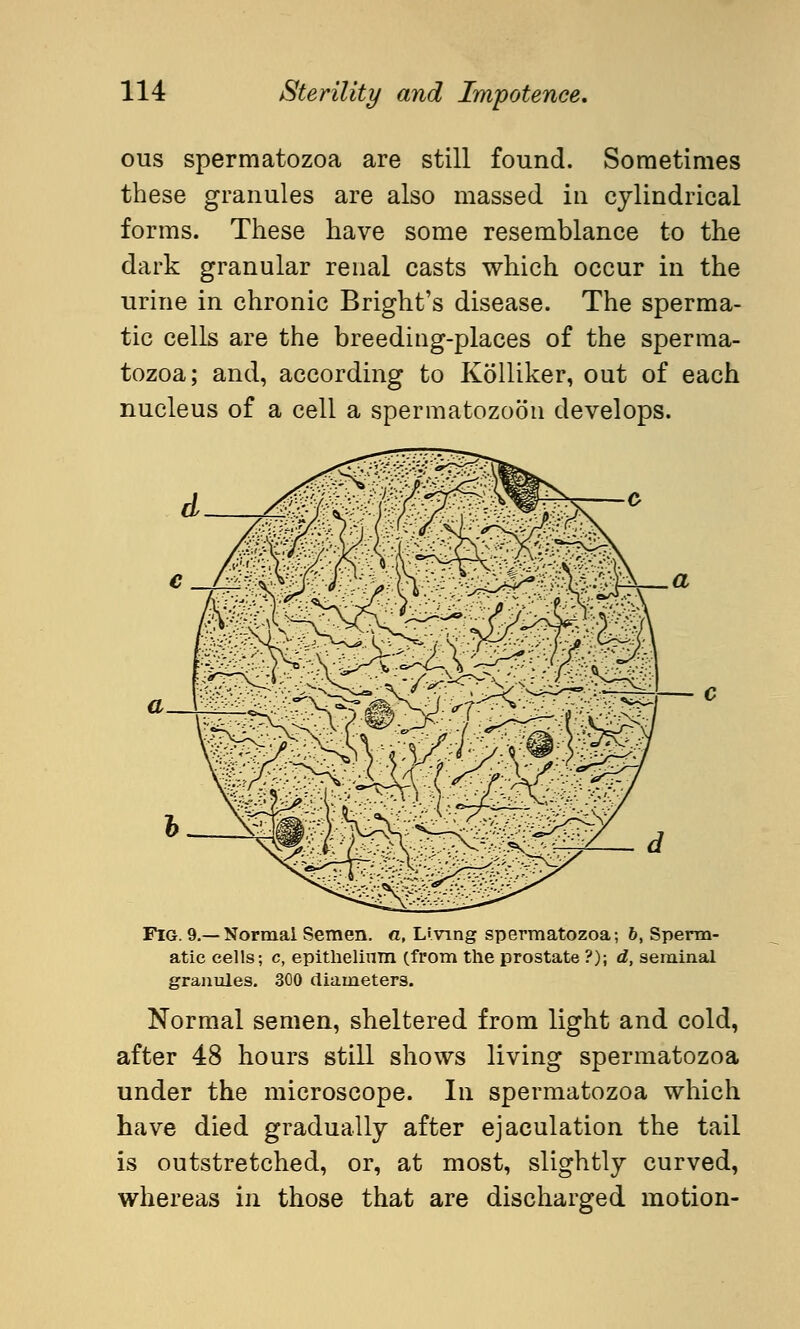 ous spermatozoa are still found. Sometimes these granules are also massed in cylindrical forms. These have some resemblance to the dark granular renal casts which occur in the urine in chronic Bright's disease. The sperma- tic cells are the breeding-places of the sperma- tozoa; and, according to Kölliker, out of each nucleus of a cell a spermatozoon develops. Fig. 9.—Normal Semen, a. Living spermatozoa; 6, Sperm- atic cells; c, epithelium (from the prostate ?); d, seminal granules. 300 diameters. Normal semen, sheltered from light and cold, after 48 hours still shows living spermatozoa under the microscope. In spermatozoa which have died gradually after ejaculation the tail is outstretched, or, at most, slightly curved, whereas in those that are discharged motion-