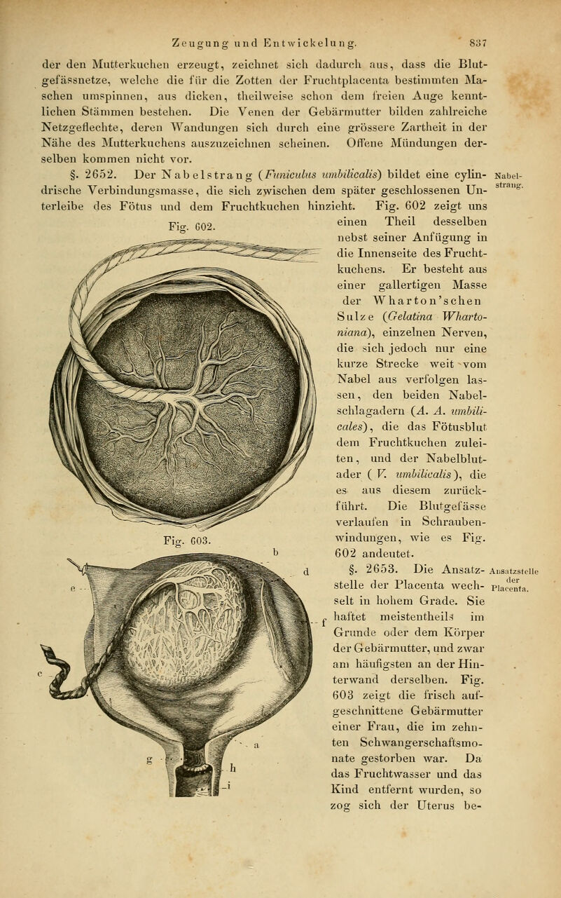 der den Mutterkuclieii erzeugt, zeichnet sich dadurch aus, dass die Blut- gefässnetze, welche die für die Zotten der FruchtpLacenta bestimmten Ma- schen umspinnen, aus dicken, theilweise schon dem l'reien Auge kennt- lichen Stämmen bestehen. Die Venen der Gebärmutter bilden zahlreiche Netzgeflechte, deren Wandungen sich durch eine grössere Zartheit in der Nähe des Mutterkuchens auszuzeichnen scheinen. Offene Mündungen der- selben kommen nicht vor. §. 2652. Der Nabelstrang (Funicidus umhüicalis) bildet eine cylin- drische Verbindungsmasse, die sich zwischen dem später geschlossenen Un- terleibe des Fötus und dem Fruchtkuchen hinzieht. Fig. 602 zeigt uns einen Theil desselben nebst seiner Anfügung in die Innenseite des Frucht- kuchens. Er besteht aus einer gallertigen Masse der Wharton'schen Sülze (Gelatina Wharto- nianä)^ einzelnen Nerven, die sich jedoch nur eine kurze Strecke weit -vom Nabel aus verfolgen las- sen , den beiden Nabel- schlagadern (J.. A. wnhili- cales), die das Fötusblut dem Fruchtkuchen zulei- ten , und der Nabelblut- ader ( V. umbilicalis)^ die es aus diesem zurück- führt. Die Blutgefässe verlaufen in Schrauben- windungen, wie es Fig. 602 andeutet. §. 2653. Die Ansatz- stelle der Placenta wech- selt in hohem Grade. Sie haftet meistentheil.^ im Grunde oder dem Körper der Gebärmutter, und zwar am häufigsten an der Hin- terwand derselben. Fig. 603 zeigt die frisch auf- geschnittene Gebärmutter einer Frau, die im zehn- ten Schwangerschaftsmo- nate gestorben war. Da das Fruchtwasser und das Kind entfernt wurden, so zog sich der Uterus be- Nabel- straiig. Aiisatzstelle der Placenfa.