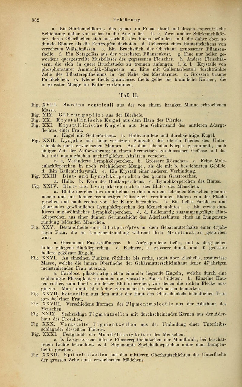 a. Ein Stärkemehlkorn, das genau im Focus stand und dessen concentrische Schichtung daher von selbst in die Augen fiel. b. c. Zwei andere Stärkemehlkör- ner, deren Oberflächen sich ausserhalb des Focus befanden und die daher eben so dunkle Ränder als die Fetttropfen darboten, d. Ueberrest eines Hautstückchens von verzehrten Wälschnüssen. e. Ein Bruchstück der Oberhaut genossener Pflanzen- theile. f. Ein Netzgefäss aus der verzehrten Pflanzenkost, g. Eine nur heller ge- wordene quergestreifte Muskelfaser des gegessenen Fleisches, h. Andere Fleischfa- sern, die sich in quere Bruchstücke zu trennen anfangen, i. k. 1. Krystalle von phosphorsaurer Ammoniak-Magnesia, m. Eine mit Gallenfarbestoff durchtränkte Zelle des Pflasterepitheliums in der Nähe des Mastdarmes, n. Grössere braune Partikelchen. o. Kleine theils grauweisse, theils gelbe bis bräunliche Körner, die in grösster Menge im Kothe vorkommen. Taf. II. Fig. XVIII. Sarcina ventriculi aus der von einem kranken Manne erbrochenen Masse. Fig. XIX. Gährungspilze aus der Bierhefe. Fig. XX. Kry st allinische Kugel aus dem Harn des Pferdes. Fig. XXI. Krystallinische Kugeln aus dem Gehirnsand des mittleren Aderge- flechtes einer Frau. a. Kugel mit Seitenfortsatz, b. Halbvererdete und durchsichtige Kugel. Fig. XXII. Lym_phe aus einer verletzten Saugader des oberen Theiles des Unter- schenkels eines erwachsenen Mannes. Aus dem lebenden Körper gesammelt, nach einiger Zeit der Aufbewahrung in einem hermetisch geschlossenen Gefässe und da- her mit mannigfachen nachträglichen Absätzen versehen. a. a. Veränderte Lymphkörperchen. b. Grössere Körnchen, c. Feine Mole- cularkörperchen in noch reichlicherer Menge, als die mit b. bezeichneten Gebilde, d. Ein Gallenfettkrystall. e. Ein Krystall einer anderen Verbindung. Fig. XXIII. Blut- und Lymphkörperchen des grünen Grasfrosches. a. Hülle, b. Kern des Blutkörperchens, c. Lymphkörperchen des Blutes, Fig. XXIV. Blut- und Lymphkörperchen des Blutes des Menschen. a. Blutkörperchen des unmittelbar vorher aus dem lebenden Menschen genom- menen und mit keiner fremdartigen Flüssigkeit verdünnten Blutes; von der Fläche gesehen und nach rechts von der Kante betrachtet, b. Ein helles farbloses und glänzendes gewöhnliches Lymphkörperchen des Menschenblutes, c. Ein etwas dun- kleres ungewöhnliches Lymphkörperchen. d. d. Rollenartig zusammengefügte Blut- körperchen aus einer dünnen Serumschicht des Aderlassblutes eines an Lungenent- zündung leidenden Menschen. Fig. XXV. Bestandtheile eines B 1 u tp fro'^fes in dem Gebärmutterhalse einer 47jäh- rigen Frau, die an Lungenentzündung während ihrer Menstruation gestorben war. a. Geronnene Faserstoffmasse, b. Aufgequollene tiefer, und c. dergleichen höher gelegene Blutkörperchen, d. lOeinere, e. grössere dunkle und f. grössere hellere gekörnte Kugeln Fig. XXVI. An einzelnen Punkten röthiiche bis rothe, sonst aber glashelle, grauweisse Masse, welche die innere Oberfläche der Gebärmutterschleimhaut jener 47jährigen menstruirenden Frau überzog. a. Farblose, pflasterartig neben einander liegende Kugeln, welche durch eine schleimigte Flüssigkeit verbunden die glasartige Masse bildeten, b. Einzelne Hau- fen rother, zum Theil veränderter Blutkörperchen, von denen die rothen Flecke aus- gingen. Man konnte hier keine geronnenen Faserstoffmassen bemerken. Fig. XXVII. Fett Zellen aus dem unter der Haut des Oberschenkels befindlichen Fett- gewebe einer Frau. Fig. XXVIII. Verschiedene Formen der Pigmentmolecüle aus der Aderhaut des Menschen. Fig. XXIX. Sechseckige Pigmentzellen mit durchscheinenden Kernen aus der Ader- haut des Frosches. Fig. XXX. Verästelte Pigmentzellen aus der Umhüllung einer Unterleibs- schlagader desselben Thieres. Fig. XXXI. Festgebilde der Mun d f lüs sigkeiten des Menschen. a b. Losgestossene älteste Pflasterepithelialzellcn der Mundhöhle, bei beschat- tetem Lichte betrachtet, c. d. Sogenannte Speichelkörperchen unter dem Lampen- lichte gesehen. Fig. XXXII. Epithelial Zellen aus den mittleren Oberhautschichten der Unterfläche der grossen Zehe eines erwachsenen Mädchens.