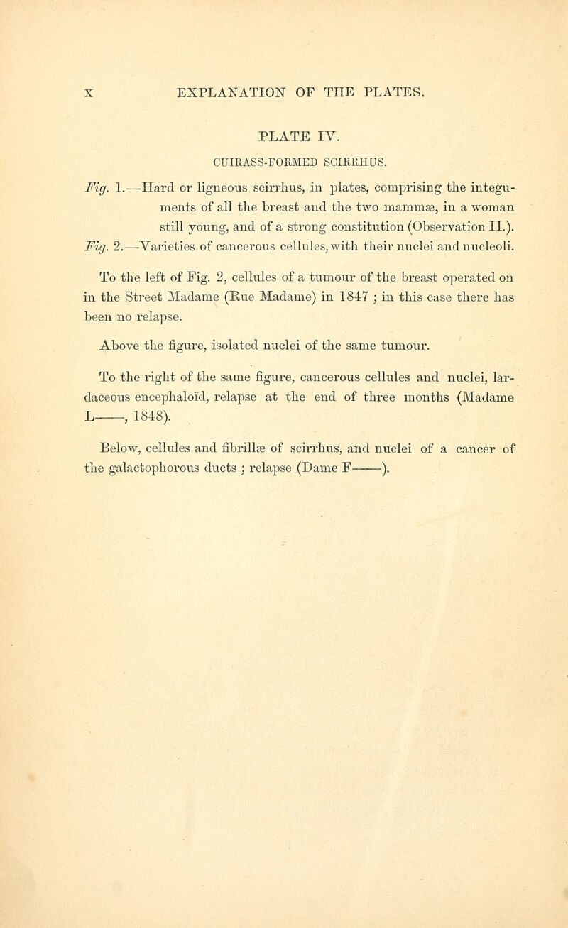 PLATE TV. CUIRASS-FORMED SCIRRHUS. Fig. 1.—Hard or ligneous scirrlius^ in plates, comprising the integu- ments of ail the breast and the two mammse, in a woman still young, and of a strong constitution (Observation II.). Fig. 2.—Varieties of cancerous cellules, with their nuclei and nucleoli. To the left of Fig. 2, cellules of a tumour of the breast operated on in the Street Madame (Hue Madame) in 1847 ; in this case there has been no relajDse. Above the figure, isolated nuclei of the same tumour. To the I'ight of the same figure, cancerous cellules and nuclei, lar- daceous encephaloi'd, relapse at the end of three months (Madame L , 1848). Below, cellules and fibrillse of scirrhus, and nuclei of a cancer of the galactophoroiis ducts ; relapse (Dame F ).