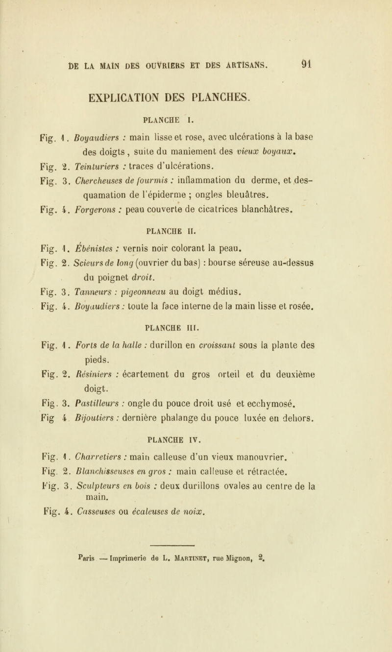 EXPLICATION DES PLANCHES. PLANCHE I. Fig. 1. Boyaudiers : main lisse et rose, avec ulcérations à la base des doigts , suite du maniement des vieux boyaux. Fig. '2. Teinturiers .'traces d'ulcérations. Fig. 3. Chercheuses de fourmis : inflammation du derme, et des- quamation de l'épiderme ; ongles bleuâtres. Fig. 4. Forgerons : peau couverte de cicatrices blanchâtres. PLANCHE II. Fig. 1. Ébénistes : vernis noir colorant la peau. Fig. 2. Scieursde /ongf (ouvrier du bas) : bourse séreuse au-dessus du poignet droit, Fig. 3. Tanneurs : pigeonneau au doigt médius. Fig. 4. Boyaudiers : toute la face interne de la main lisse et rosée. PLANCHE III. Fig. 1. Forts de la halle : durillon en croissant sous la plante des pieds. Fig. 2. Résiniers : écartement du gros orteil et du deuxième doigt. Fig. 3. Pastilleurs : ongle du pouce droit usé et ecchymose. Fig 4. Bijoutiers : dernière phalange du pouce luxée en dehors. PLANCHE IV. Fig. 1. Charretiers : main calleuse d'un vieux manouvrier. Fig. 2. Blanchisseuses en gros : main calleuse et rétractée. Fig. 3. Sculpteurs en bois : deux durillons ovales au centre de la main. Fig. 4. Casseuses ou écaleuses de noix. Paris — Imprimerie de L, Martinet, rue Mignon, 2,