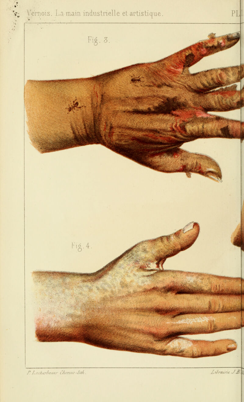 J'. .Ljç-/ccrl'aucr (7//-(V//r -/i//i