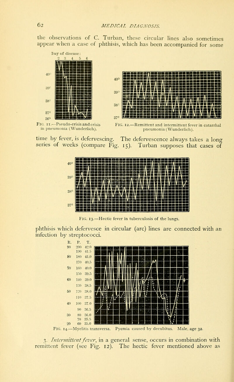 the observations of C, Turban, these circular h'nes also sometimes appear when a case of phthisis, which has been accompanied for some Day of ili Fig. Pseudo-crisis and crisis in pneumonia (Wunderlich). HSiEStSiSSiSSBSSsSSBg 40° SBBiKiaussaissssBSSsaaaSsi 39° ssHiiaiJSisssiasiisiissssansgsa ■HBBIiBUBUH.0HiaB WilW ITlMr.iMll—■ ■»>l«IMMBMiPMMHIWHI«WHM»lWiiWllWWWM 38^ ■FAl«BHHHBHIIiBI'IH*B>HraiWtWlWBnnBn ■■■■&SSSSSEMa5l'j5MBaMwSAwB BBBiBSBSSESSliB^iLiSLiS^i^^^ 37=' Fig. 12.—Remittent and intermittent fever in catarrhal pneumonia (Wunderlich). time by fever, is defervescing. The defervescence always takes a long series of weeks (compare Fig. 15). Turban supposes that cases of 40° 39° 38° 37° ■■■■■■■■■■■■■■■■■■■■■l.fllMWI.IMM— 99S!!^aaaMHBiHHBHHSniiMiim,iHi.iHriiBnini ~^a.WlHIBBBnBrfiiaBBBBflWII,«H««aiBBlTIHITIBm _JBlTlBB5BIIIBllBBBaBr«Brikl«IIBBBBflllHI|5M ViBilBBBB/llBIIBnBHBiaBfBlTMIiniiaHianiaBBBl^r MBBBBMBaBiVWA^BMBaiaaUBUBIIIBIMBBBBBI BBBBiWtWBIIBViB.WABBtlBBBBBIIIBlllBBBBBBH BBBBIBAViBIIBiTIBkraVflilTlBBBBBIIIBIIIBBBBBBB BBBBIfB.TIBllBMBHBtllBIIBaBBBI'IBinBBBBBB BBBBIT/HtaBiaaBBBailBBIBBBBBIIBUa^ ■BBniiBBBBBBBBBBBBHiHBi ■■■■■■! Fig. 13.—Hectic fever in tuberculosis of the lungs. phthisis which defervesce in circular (arc) lines are connected with an infection by streptococci. R. P. T. 90 200 42.0 190 41.5 80 180 41.0 170 40.5 VO 160 40.0 150 39.5 60 140 39.0 130 38.5 50 120 38.0 no 37.5 40 100 37.0 90 36.5 30 80 36.0 70 35.5 20 60 35.0 as liiiiiiiiiiiiiiiii eryniiifi li II Hill miiHi IIBHH Eiamissimn isai m ■I ni Hi Fig. 14.—Myelitis transversa. Pyemia caused by decubitus. Male, age 32. 3. Intennittentfever, in a general sense, occurs in combination with remittent fever (see Fig. 12). The hectic fever mentioned above as