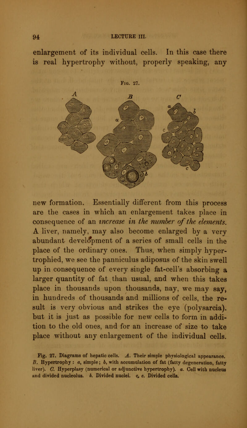 enlargement of its individual cells. In this case there is real hypertrophy without, properly speaking, any new formation. Essentially different from this process are the cases in which an enlargement takes place in consequence of an increase in the number of the elements. A liver, namely, may also become enlarged by a very abundant development of a series of small cells in the place of the ordinary ones. Thus, when simply hyper- trophied, we see the panniculus adiposus of the skin swell up in consequence of every single fat-cell's absorbing a larger quantity of fat than usual, and when this takes place in thousands upon thousands, nay, we may say, in hundreds of thousands and millions of cells, the re- sult is very obvious and strikes the eye (polysarcia). but it is just as possible for new cells to form in addi- tion to the old ones, and for an increase of size to take place without any enlargement of the individual cells. Fig. 27. Diagrams of hepatic cells. A. Their simple physiological appearance. B. Hypertrophy : a, simple; 6, with accumulation of fat (fatty degeneration, fatty liver). C. Hyperplasy (numerical or adjunctive hypertrophy), a. Cell with nucleus and divided nucleolus, b. Divided nuclei, c, c. Divided cells.