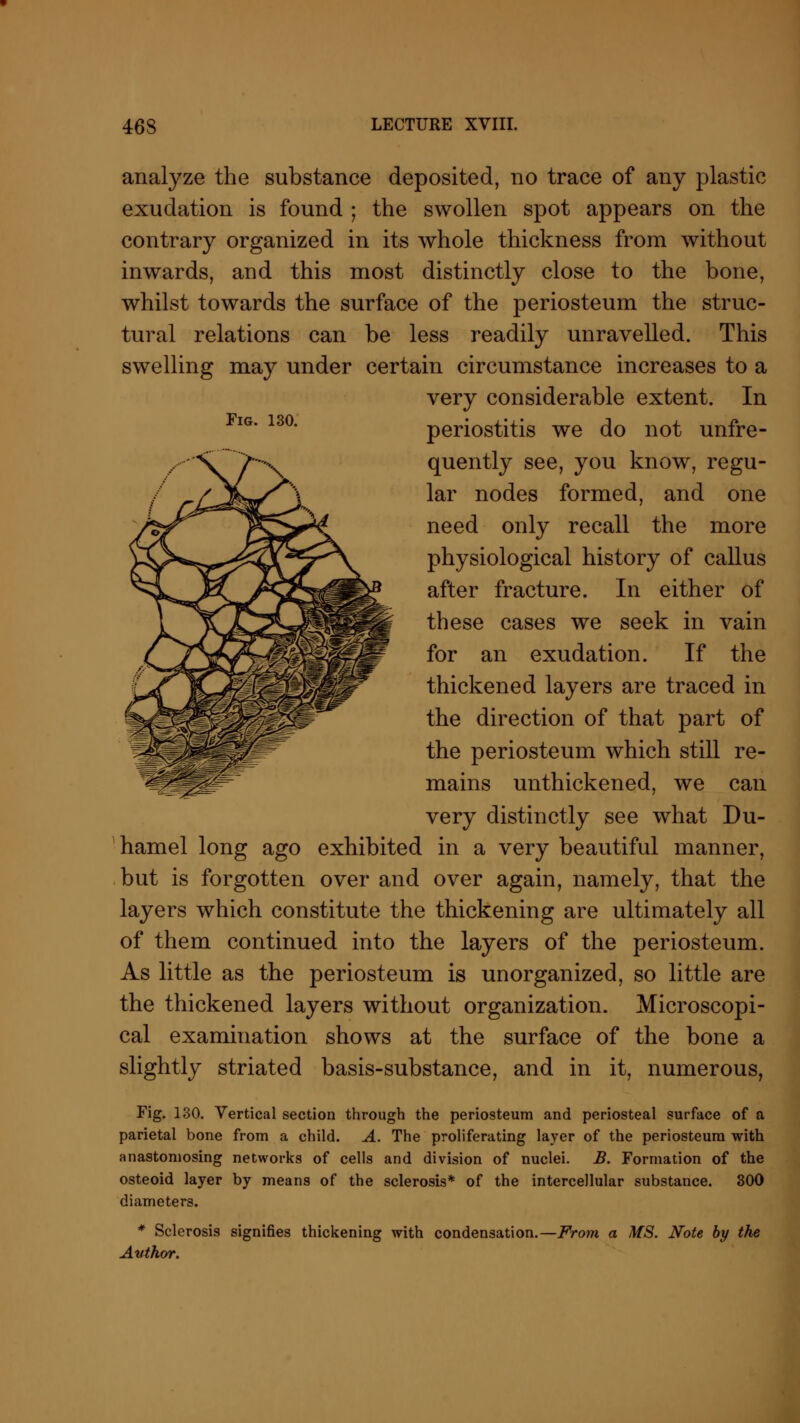Fig. 130. analyze the substance deposited, no trace of any plastic exudation is found ; the swollen spot appears on the contrary organized in its whole thickness from without inwards, and this most distinctly close to the bone, whilst towards the surface of the periosteum the struc- tural relations can be less readily unravelled. This swelling may under certain circumstance increases to a very considerable extent. In periostitis we do not unfre- quently see, you know, regu- lar nodes formed, and one need only recall the more physiological history of callus after fracture. In either of these cases we seek in vain for an exudation. If the thickened layers are traced in the direction of that part of the periosteum which still re- mains unthickened, we can very distinctly see what Du- hamel long ago exhibited in a very beautiful manner, but is forgotten over and over again, namely, that the layers which constitute the thickening are ultimately all of them continued into the layers of the periosteum. As little as the periosteum is unorganized, so little are the thickened layers without organization. Microscopi- cal examination shows at the surface of the bone a slightly striated basis-substance, and in it, numerous, Fig. 130. Vertical section through the periosteum and periosteal surface of a parietal bone from a child. A. The proliferating layer of the periosteum with anastomosing networks of cells and division of nuclei. B. Formation of the osteoid layer by means of the sclerosis* of the intercellular substance. 300 diameters. * Sclerosis signifies thickening with condensation.—From a MS. Note by the Author.