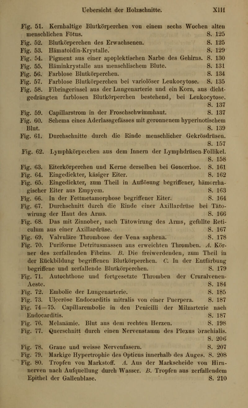 Fig. 51. Kernhaltige Blutkörperchen von einem sechs Wochen alten menschlichen Fötus. S. 125 Fig. 52. Blutkörperchen des Erwachsenen. S. 125 Fig. 53. Hämatoidin-Krystalle. S. 129 Fig. 54. Pigment aus einer apoplektischen Narbe des Gehirns. S. 130 Fig. 55. Häminkrystalle aus menschlischem Blute. S. 131 Fig. 56. Farblose Blutkörperchen. S. 134 Fig. 57. Farblose Blutkörperchen bei variolöser Leukocytose. S. 135 Fig. 58. Fibringerinsel aus der Lungenarterie und ein Korn, aus dicht- gedrängten farblosen Blutkörperchen bestehend, bei Leukocytose. S. 137 Fig. 59. Capillarstrom in der Froschschwimmhaut. S. 137 Fig. 60. Schema eines Aderlassgefässes mit geronnenem hyperinotischem Blut. S. 139 Fig. 61. Durchschnitte durch die Rinde menschlicher Gekrösdrüsen. S. 157 Fig. 62. Lymphkörpeichen aus dem Innern der Lymphdrüsen-Follikel. S. 158 Fig. 63. Eiterkörperchen und Kerne derselben bei Gonorrhoe. S. 161 Fig. 64. Eingedickter, käsiger Eiter. S. 162 Fig. 65. Eingedickter, zum Theil in Auflösung begriffener, hämorrha- gischer Eiter aus Empyem. S. 163 Fig. 66. In der Fettmetamorphose begriffener Eiter. S. 164 Fig. 67. Durchschnitt durch die Rinde einer Axillardrüse bei Täto- wirung der Haut des Arms. S. 166 Fig. 68. Das mit Zinnober, nach Tätowirung des Arms, gefüllte Reti- culum aus einer Axillardrüse. S. 167 Fig. 69. Valvuläre Thrombose der Vena saphena. S. 178 Fig. 70. Puriforme Detritusmassen aus erweichten Thromben. A. Kör- ner des zerfallenden Fibrins. B. Die freiwerdenden, zum Theil in der Rückbildung begriffenen Blutkörperchen. C. In der Entfärbung begriffene und zerfallende Blutkörperchen. S. 179 Fig. 71. Autochthone und fortgesetzte Thromben der Cruralvenen- Aeste. S. 184 Fig. 72. Embolie der Lungenarterie. S. 185 Fig. 73. Ulceröse Endocarditis mitralis von einer Puerpera. S. 187 Fig. 74—75. Capillarembolie in den Penicilli der Milzarteiie nach Endocarditis. S. 187 Fig. 76. Melanämie. Blut aus dem rechten Herzen. S. 198 Fig. 77. Querschnitt durch einen Nervenstamm des Plexus brachialis. S. 206 Fig. 78. Graue und weisse Nervenfasern. S. 207 Fig. 79. Markige Hypertrophie des Opticus innerhalb des Auges. S. 208 Fig. 80. Tropfen von Markstoff. A. Aus der Markscheide von Hirn- nerven nach Aufquellung durch Wasser. B. Tropfen aus zerfallendem Epithel der Gallenblase. S. 210