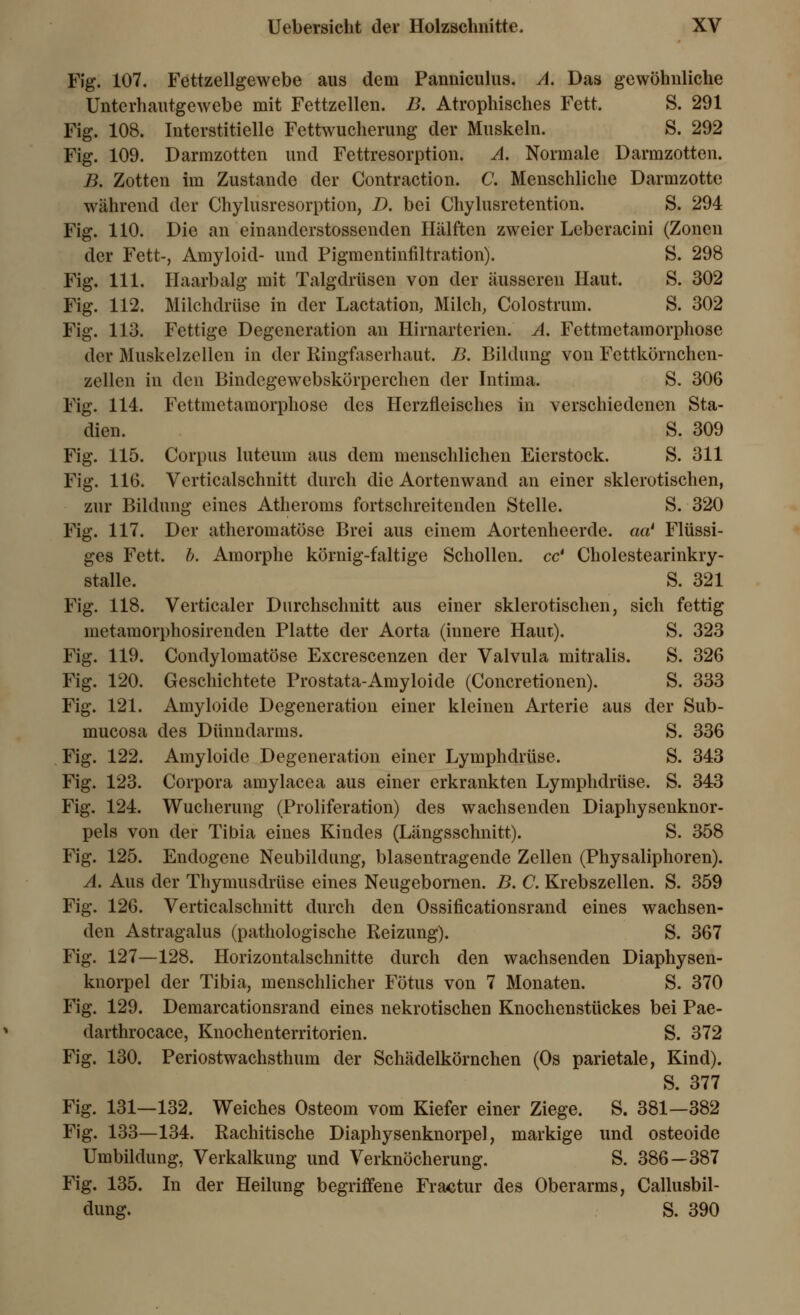 Fig. 107. Fettzellgewebe aus dem Panniculus. A. Das gewöhnliche Unterhautgewebe mit Fettzellen. B. Atrophisches Fett. S. 291 Fig. 108. Interstitielle Fettwucherung der Muskeln. S. 292 Fig. 109. Darmzotten und Fettresorption. A. Normale Darmzotten. B. Zotten im Zustande der Contraction. C. Menschliche Darmzotte während der Chylusresorption, D. bei Chylusretention. S. 294 Fig. 110. Die an einanderstossenden Hälften zweier Lebcracini (Zonen der Fett-, Amyloid- und Pigmentinfiltration). S. 298 Fig. 111. Haarbalg mit Talgdrüsen von der äusseren Haut. S. 302 Fig. 112. Milchdrüse in der Lactation, Milch, Colostrum. S. 302 Fig. 113. Fettige Degeneration an Hirnarterien. A. Fettmetamorphose der Muskelzcllen in der Kingfaserhaut. B. Bildung von Fcttkörnchen- zellen in den Bindegewebskörperchen der Intima. S. 306 Fig. 114. Fettmetamorphose des Herzfleisches in verschiedenen Sta- dien. S. 309 Fig. 115. Corpus luteum aus dem menschlichen Eierstock. S. 311 Fig. 116. Verticalschnitt durch die Aortenwand an einer sklerotischen, zur Bildung eines Atheroms fortschreitenden Stelle. S. 320 Fig. 117. Der atheromatöse Brei aus einem Aortenheerde. aa' Flüssi- ges Fett, b. Amorphe körnig-faltige Schollen, cc' Cholestearinkry- stalle. S. 321 Fig. 118. Verticaler Durchschnitt aus einer sklerotischen, sich fettig metamorphosirenden Platte der Aorta (iunere Haut). S. 323 Fig. 119. Condylomatöse Excrescenzen der Valvula mitralis. S. 326 Fig. 120. Geschichtete Prostata-Amyloide (Concretionen). S. 333 Fig. 121. Amyloide Degeneration einer kleinen Arterie aus der Sub- mueosa des Dünndarms. S. 336 Fig. 122. Amyloide Degeneration einer Lymphdrüse. S. 343 Fig. 123. Corpora amylacea aus einer erkrankten Lymphdrüse. S. 343 Fig. 124. Wucherung (Proliferation) des wachsenden Diaphysenknor- pels von der Tibia eines Kindes (Längsschnitt). S. 358 Fig. 125. Endogene Neubildung, blasentragende Zellen (Physaliphoren). A. Aus der Thymusdrüse eines Neugebomen. B. C. Krebszellen. S. 359 Fig. 126. Verticalschnitt durch den Ossificationsrand eines wachsen- den Astragalus (pathologische Reizung). S. 367 Fig. 127—128. Horizontalschnitte durch den wachsenden Diaphysen- knorpel der Tibia, menschlicher Fötus von 7 Monaten. S. 370 Fig. 129. Demarcationsrand eines nekrotischen Knochenstückes bei Pae- darthrocace, Knochenterritorien. S. 372 Fig. 130. Periostwachsthum der Schädelkörnchen (Os parietale, Kind). S. 377 Fig. 131—132. Weiches Osteom vom Kiefer einer Ziege. S. 381—382 Fig. 133—134. Rachitische Diaphysenknorpel, markige und osteoide Umbildung, Verkalkung und Verknöcherung. S. 386—387 Fig. 135. In der Heilung begriffene Fractur des Oberarms, Callusbil- dung. S. 390