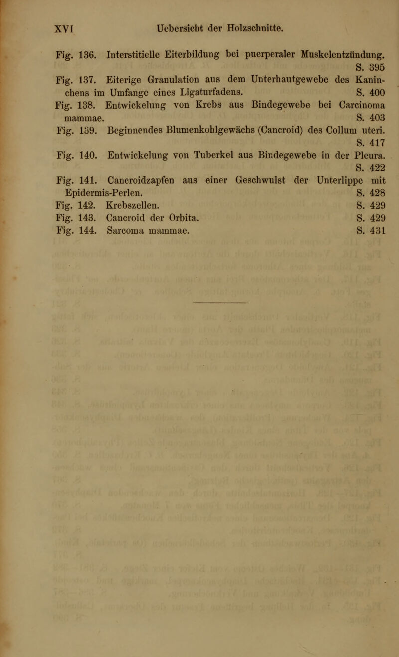 Fig. 136. Interstitielle Eiterbildung bei puerperaler Muskelentzündung. S. 395 Fig. 137. Eiterige Granulation aus dem Unterhautgewebe des Kanin- chens im Umfange eines Ligaturfadens. S. 400 Fig. 138. Entwicklung von Krebs aus Bindegewebe bei Carcinoma mammae. S. 403 Fig. 139. Beginnendes Blumenkohlgewächs (Cancroid) des Collum uteri. S. 417 Fig. 140. Entwicklung von Tuberkel aus Bindegewebe in der Pleura. S. 422 Fig. 141. Cancroidzapfen aus einer Geschwulst der Unterlippe mit Epidermis-Perlen. S. 428 Fig. 142. Krebszellen. S. 429 Fig. 143. Cancroid der Orbita. S. 429 Fig. 144. Sarcoma mammae. S. 431