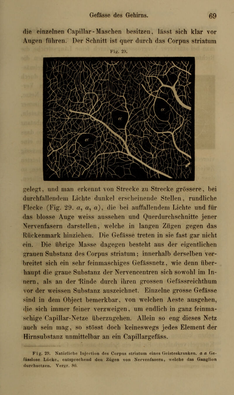 die einzelnen Capillar-Maschen besitzen, lässt sich klar vor Augen führen. Der Schnitt ist quer durch das Corpus striatum Fi*. 29. gelegt, und man erkennt von Strecke zu Strecke grössere, bei durchfallendem Lichte dunkel erscheinende Stellen, rundliche Flecke (Fig. 29. a, a, a), die bei auffallendem Lichte und für das blosse Auge weiss aussehen und Querdurchschnitte jener Nervenfasern darstellen, welche in langen Zügen gegen das Rückenmark hinziehen. Die Gefässe treten in sie fast gar nicht ein. Die übrige Masse dagegen besteht aus der eigentlichen grauen Substanz des Corpus striatum; innerhalb derselben ver- breitet sich ein sehr feinmaschiges Gefässnetz, wie denn über- haupt die graue Substanz der Nervencentren sich sowohl im In- nern, als an der 'Rinde durch ihren grossen Gefässreichthum vor der weissen Substanz auszeichnet. Einzelne grosse Gefässe sind in dem Object bemerkbar, von welchen Aeste ausgehen, die sich immer feiner verzweigen, um endlich in ganz feinma- schige Capillar-Netze überzugehen. Allein so eng dieses Netz auch sein mag, so stösst doch keineswegs jedes Element der Hirnsubstanz unmittelbar an ein Capillargefäss. Fig. 29. Natürliche Injection des Corpus striatum eines Geisteskranken, aa Ge- fasslose Lücke, entsprechend den Zügen von Nervenfasern, welche (las Ganglion durchsetzen. Verpr. SO.