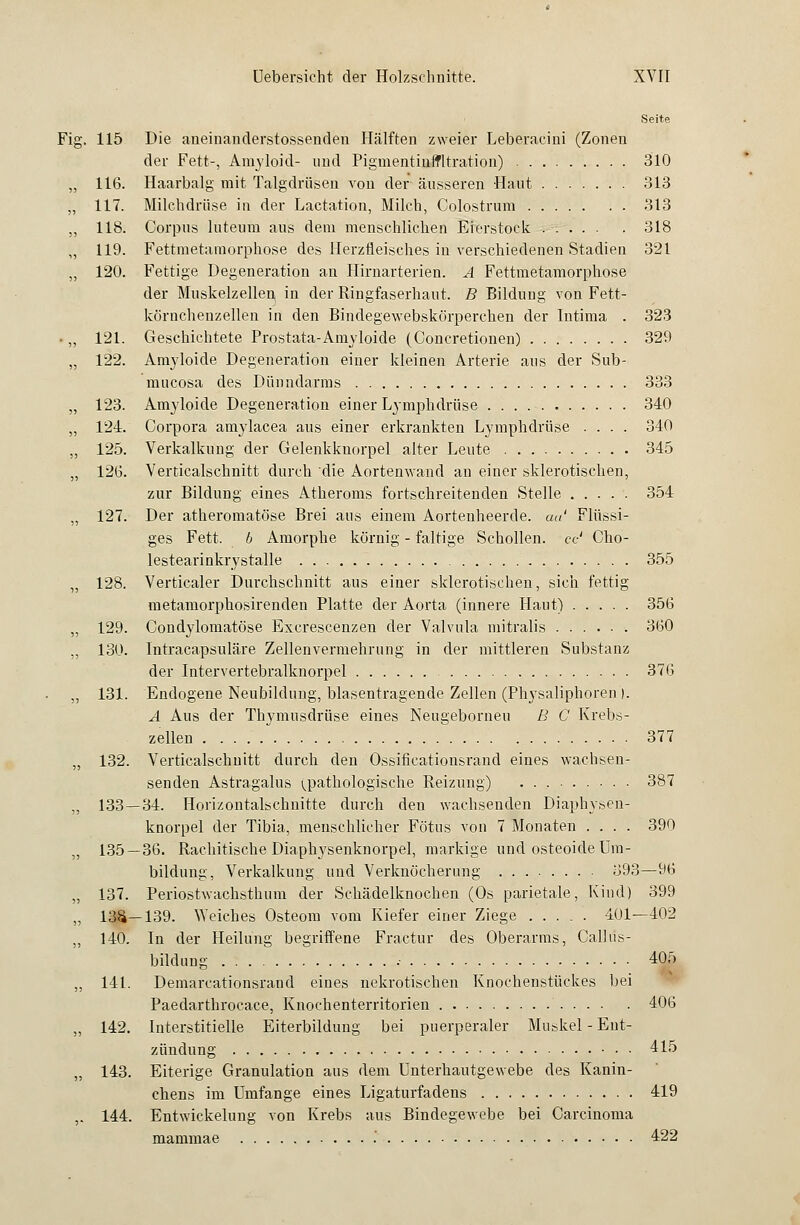 Seite Fig. 115 Die aneinanderstossenden Hälften zweier Leberacini (Zonen der Fett-, Amyloid- und Pigmentinffltration) 310 ,, 116. Haarbalg mit Talgdrüsen von der äusseren Haut 313 „ 117. Milchdrüse in der Lactation, Milch, Colostrum 313 „ 118. Corpus luteum aus dem menschlichen Eierstock ..... . 318 „ 119. Fettmetamorphose des Herzfleisches in verschiedenen Stadien 321 „ 120. Fettige Degeneration an Hirnarterien. A Fettmetamorphose der Muskelzellen, in der Ringfaserhaut. B Bildung von Fett- köruchenzellen in den Bindegewebskörperchen der Intima . 323 • „ 121. Geschichtete Prostata-Amyloide (Concretionen) 329 „ 122. Amyloide Degeneration einer kleinen Arterie aus der Sub- mucosa des Dünndarms 333 „ 123. Amyloide Degeneration einer Lymphdrüse . . . 340 „ 124. Corpora amylacea aus einer erkrankten Lymphdrüse .... 340 „ 125. Verkalkung der Gelenkkuorpel alter Leute 345 „ 126. Verticalschnitt durch die Aortenwand an einer sklerotischen, zur Bildung eines Atheroms fortschreitenden Stelle 354 „ 127. Der atheromatöse Brei aus einem Aortenheerde. au' Flüssi- ges Fett, b Amorphe körnig - faltige Schollen, cc' Cho- lestearinkrystalle 355 „ 128. Verticaler Durchschnitt aus einer sklerotischen, sich fettig metamorphosirenden Platte der Aorta (innere Haut) 356 „ 129. Condylomatöse Excrescenzen der Valvula mitralis 360 „ 130. Intracapsuläre Zellenvermehrung in der mittleren Substanz der Intervertebralknorpel 376 „ 131. Endogene Neubildung, blasentragende Zellen (Physaliphoren). A Aus der Thymusdrüse eines Neugeborneu B C Krebs- zellen 377 „ 132. Verticalschnitt durch den Ossificationsrand eines wachsen- senden Astragalus ^Pathologische Reizung) 387 „ 133 — 34. Horizontalschnitte durch deu wachsenden Diaphysen- knorpel der Tibia, menschlicher Fötus von 7 Monaten .... 390 „ 135 — 36. Rachitische Diaphysenknorpel, markige und osteoide Um- bildung, Verkalkung und Verknöcherung 893—96 „ 137. Periostwachsthum der Schädelknochen (Os parietale, Kind) 399 „ 13S—139. 'Weiches Osteom vom Kiefer einer Ziege 401—402 „ 140. In der Heilung begriffene Fractur des Oberarms, Callus- bildnng .• 405 „ 141. Demarcationsrand eines nekrotischen Knochenstückes bei Paedarthrocace, Knochenterritorien 406 „ 142. Interstitielle Eiterbildung bei puerperaler Muskel - Ent- zündung 415 „ 143. Eiterige Granulation aus dem Unterhautgewebe des Kanin- chens im Umfange eines Ligaturfadens 419 ,. 144. Entwickelung von Krebs aus Bindegewebe bei Carcinoma mammae .' 422