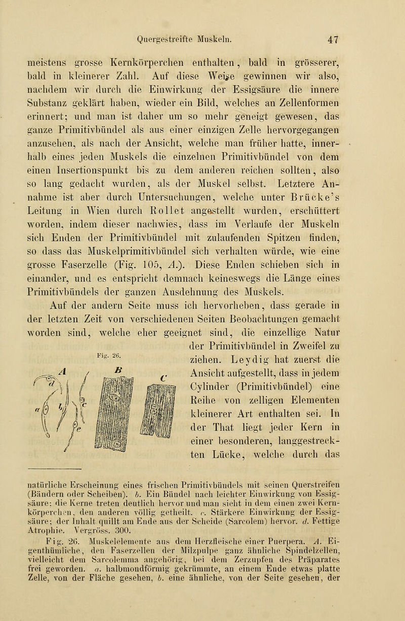 meistens grosse Kernkörperehen enthalten, bald in grösserer, bald in kleinerer Zahl. Auf diese Wei^e gewinnen wir also, nachdem wir durch die Einwirkung der Essigsäure die innere Substanz geklärt haben, wieder ein Bild, welches an Zellenformen erinnert; und man ist daher um so mehr geneigt gewesen, das ganze Primitivbündel als aus einer einzigen Zelle hervorgegangen anzusehen, als nach der Ansicht, welche man früher hatte, inner- halb eines jeden Muskels die einzelnen Primitivbündel von dem einen lasertionspunkt bis zu dem anderen reichen sollten, also so lang gedacht wurden, als der Muskel selbst. Letztere An- nahme ist aber durch Untersuchungen, welche unter Brücke's Leitung in Wien durch Rollet angestellt wurden, erschüttert worden, indem dieser nachwies, dass im Verlaufe der Muskeln sich Enden der Primitivbündel mit zulaufenden Spitzen finden, so dass das Muskelprimitivbündel sich verhalten würde, wie eine grosse Faserzelle (Fig. 105, A.). Diese Enden schieben sich in einander, und es entspricht demnach keineswegs die Länge eines Primitivbündels der ganzen Ausdehnung des Muskels. Auf der andern Seite muss ich hervorheben, dass gerade in der letzten Zeit von verschiedenen Seiten Beobachtungen gemacht worden sind, welche eher geeignet sind, die einzellige Natur der Primitivbündel in Zweifel zu ziehen. Leydig hat zuerst die Ansicht aufgestellt, dass in jedem Cylinder (Primitivbündel) eine Reihe von zelligen Elementen kleinerer Art enthalten sei. In der That liegt jeder Kern in einer besonderen, langgestreck- ten Lücke, welche durch das natürliche Erscheinung eines frischen Primitivbündels mit seinen Querstreifen (Bändern oder Scheiben), b. Ein Bündel nach leichter Einwirkung von Essig- säure: die Kerne treten deutlich hervor und mau sieht in dem einen zwei Kern- körperchen, den anderen völlig getheilt. <■. Stärkere Einwirkung der Essig- säure; der Inhalt quillt am Ende aus der Scheide (Sarcolem) hervor. (/. Fettige Atrophie. Vergröss. 300. Fig. 26. Muskelelemente aus dem Herzfleische einer Puerpera. A. Ei- genthümliche, den Faserzellen der Milzpulpe ganz ähnliche Spindelzellen, vielleicht dem Sarcolemma angehörig, bei dem Zerzupfen des Präparates frei geworden, a. halbmondförmig gekrümmte, an einem Ende etwas platte Zelle, von der Fläche gesehen, b. eine ähnliche, von der Seite gesehen, der