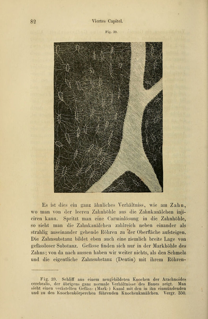 Fi«. 39. Es ist dies ein ganz ähnliches Verhältniss, wie am Zahn, wo man von der leeren Zahnhöhle aus die Zahnkanälchen inji- ciren kann. Spritzt man eine Carminlösung in die Zahnhöhle, so sieht man die Zahnkanälchen zahlreich neben einander als strahlig auseinander gehende Röhren zu 'der Oberfläche aufsteigen. Die Zahnsubstanz bildet eben auch eine ziemlich breite Lage von gefässloser Substanz. Gefässe finden sich nur in der Markhöhle des Zahns; von da nach aussen haben wir weiter nichts, als den Schmelz und die eigentliche Zahnsubstanz (Dentin) mit ihrem Röhren- Fig. 39. Schliff aus einem neugebildeten Knochen der Arachnoides cerebralis, der übrigens ganz normale Verhältnisse des Baues zeigt. Man sieht einen verästelten Gefäss- (Mark-) Kanal mit den in ihn einmündenden und zu den Knochenkörperchen führenden Knochenkanälchen. Vergr. 350.