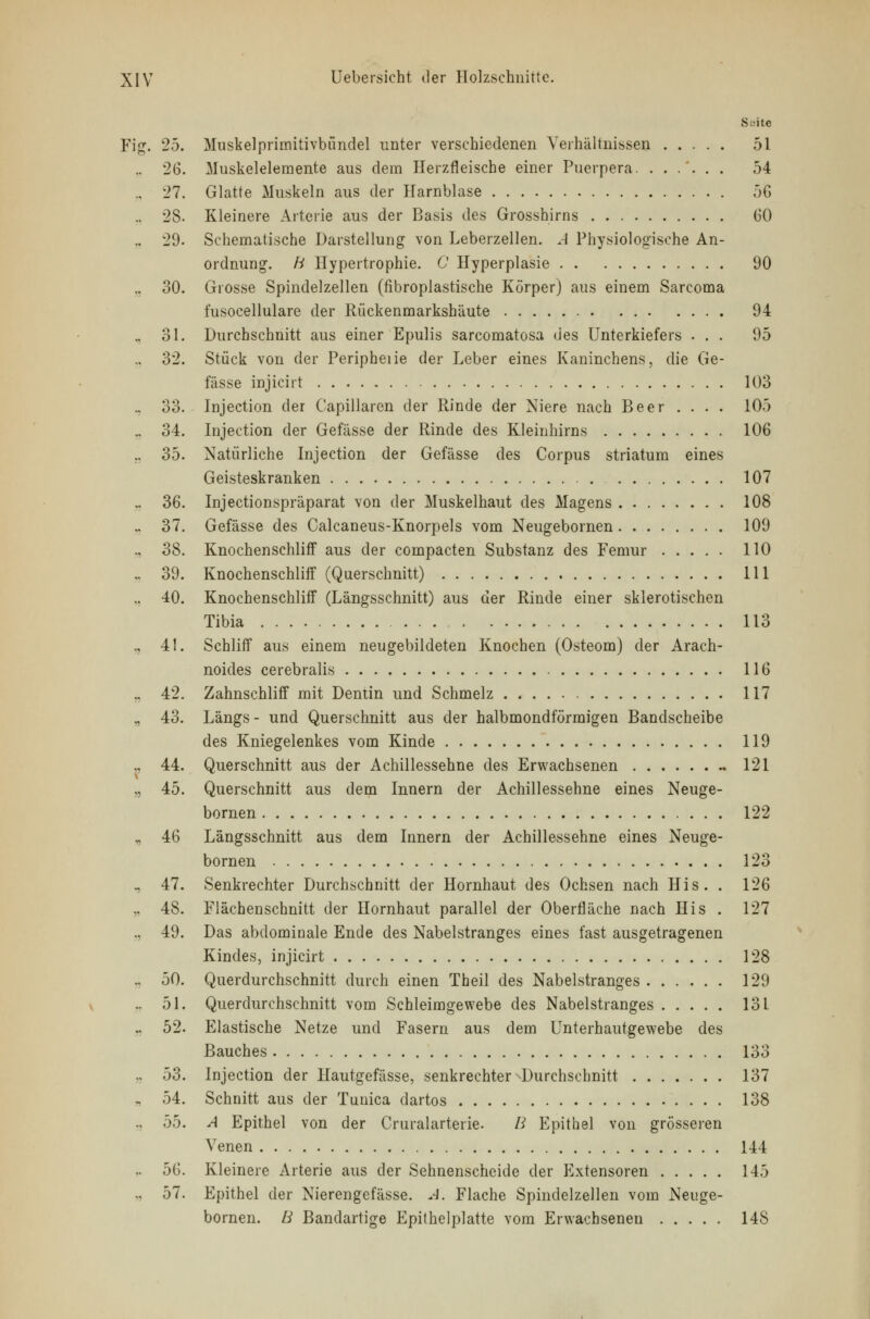 Suite Fig. 25. Muskelprimitivbündel unter verschiedenen Verhältnissen 51 .. 26. Muskelelemente aus dem Herzfleische einer Puerpera. ...... 54 .. 27. Glatte Muskeln aus der Harnblase 5G .. 28. Kleinere Arterie aus der Basis des Grosshirns 60 .. 29. Schematische Darstellung von Leberzellen. A Physiologische An- ordnung, h Hypertrophie. 0 Hyperplasie 90 30. Grosse Spindelzellen (fibroplastische Körper) aus einem Sarcoma i'usocellulare der Rückenmarkshäute 94 .. 31. Durchschnitt aus einer Epulis sarcomatosa des Unterkiefers ... 95 .. 32. Stück von der Peripheiie der Leber eines Kaninchens, die Ge- lasse injicirt 103 .. 33. Injection der Capillaren der Rinde der Niere nach Beer ... . 105 .. 34. Injection der Gefässe der Rinde des Kleinhirns 106 .. 35. Natürliche Injection der Gefässe des Corpus striatum eines Geisteskranken 107 .. 36. Injectionspräparat von der Muskelhaut des Magens 108 .. 37. Gefässe des Calcaneus-Knorpels vom Neugebornen 109 ., 38. Knochenschliff aus der compacten Substanz des Femur 110 ,. 39. Knochenschliff (Querschnitt) 111 ,, 40. Knochenschliff (Längsschnitt) aus der Rinde einer sklerotischen Tibia 113 „ 41. Schliff aus einem neugebildeten Knochen (Osteom) der Arach- noides cerebralis 116 .. 42. Zahnschliff mit Dentin und Schmelz 117 „ 43. Längs - und Querschnitt aus der halbmondförmigen Bandscheibe des Kniegelenkes vom Kinde 119 „ 44. Querschnitt aus der Achillessehne des Erwachsenen - 121 „ 45. Querschnitt aus dem Innern der Achillessehne eines Neuge- bornen 122 ,, 46 Längsschnitt aus dem Innern der Achillessehne eines Neuge- bornen 123 , 47. Senkrechter Durchschnitt der Hornhaut des Ochsen nach His. . 126 „ 48. Flächenschnitt der Hornhaut parallel der Oberfläche nach His . 127 ., 49. Das abdominale Ende des Nabelstranges eines fast ausgetragenen Kindes, injicirt 128 .. 50. Querdurchschnitt durch einen Theil des Nabelstranges 129 .. 51. Querdurchschnitt vom Schleimgewebe des Nabelstranges 131 .. 52. Elastische Netze und Fasern aus dem Unterhautgewebe des Bauches 133 .. 53. Injection der Hautgefässe, senkrechter Durchschnitt 137 „ 54. Schnitt aus der Tunica dartos 138 .. 55. A Epithel von der Cruralarterie. ß Epithel von grösseren Venen 144 .. 56. Kleinere Arterie aus der Sehnenscheide der Extensoren 145 .. 57. Epithel der Nierengefässe. A, Flache Spindelzellen vom Neuge- bornen. B Bandartige Epithelplatte vom Erwachsenen 148