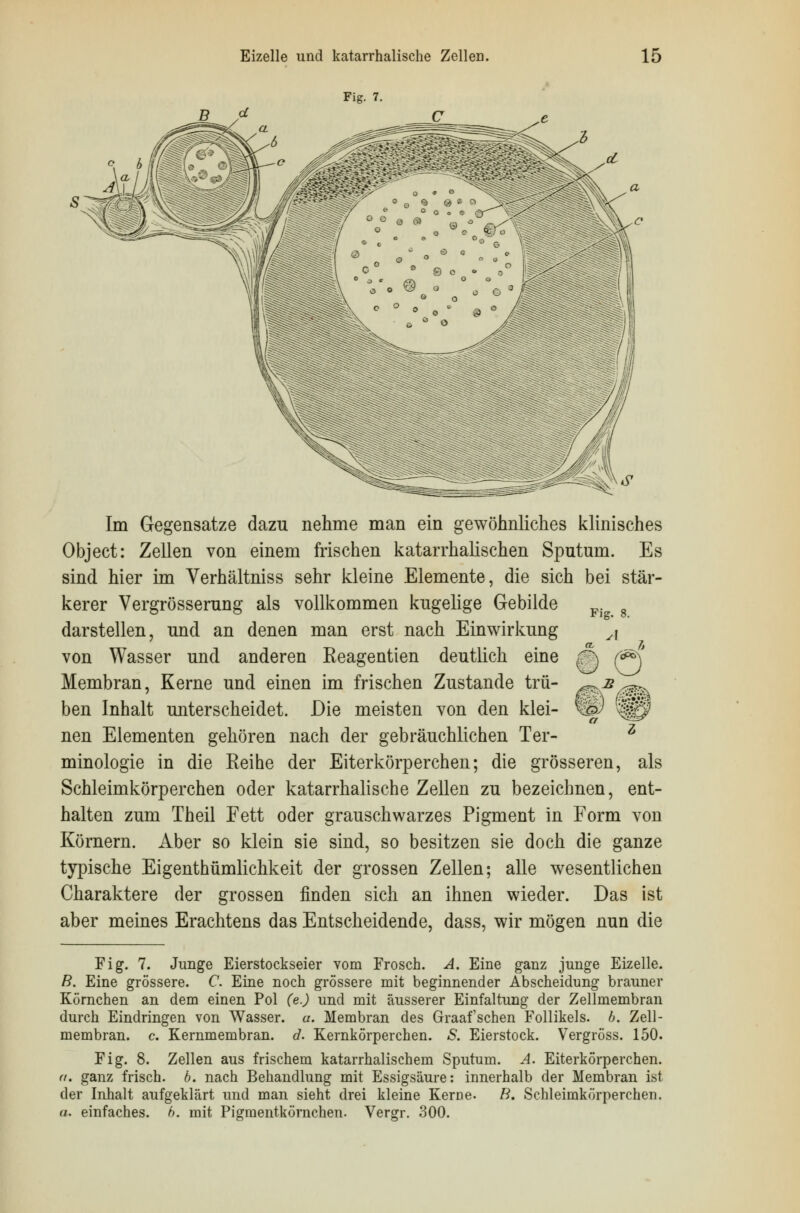 Fig. 7. Im Gegensatze dazu nehme man ein gewöhnliches klinisches Object: Zellen von einem frischen katarrhalischen Sputum. Es sind hier im Verhältniss sehr kleine Elemente, die sich bei stär- kerer Vergrösserung als vollkommen kugelige Gebilde K 8 darstellen, und an denen man erst nach Einwirkung A von Wasser und anderen Keagentien deutlich eine (% (**\ Membran, Kerne und einen im frischen Zustande trü- ^b^^ ben Inhalt unterscheidet. Die meisten von den klei- Wy $$i$ nen Elementen gehören nach der gebräuchlichen Ter- z minologie in die Reihe der Eiterkörperchen; die grösseren, als Schleimkörperchen oder katarrhalische Zellen zu bezeichnen, ent- halten zum Theil Fett oder grauschwarzes Pigment in Form von Körnern. Aber so klein sie sind, so besitzen sie doch die ganze typische Eigenthümlichkeit der grossen Zellen; alle wesentlichen Charaktere der grossen finden sich an ihnen wieder. Das ist aber meines Erachtens das Entscheidende, dass, wir mögen nun die Fig. 7. Junge Eierstockseier vom Frosch. A. Eine ganz junge Eizelle. B. Eine grössere. C. Eine noch grössere mit beginnender Abscheidung brauner Körnchen an dem einen Pol (e.) und mit äusserer Einfaltung der Zellmembran durch Eindringen von Wasser, a. Membran des Graafschen Follikels, b. Zell- membran, c Kernmembran, d. Kernkörperchen. S. Eierstock. Vergröss. 150. Fig. 8. Zellen aus frischem katarrhalischem Sputum. A. Eiterkörperchen. u. ganz frisch, b. nach Behandlung mit Essigsäure: innerhalb der Membran ist der Inhalt aufgeklärt und man sieht drei kleine Kerue. B. Schleimkörperchen. a. einfaches, b. mit Pigmentkörnchen. Vergr. 300.