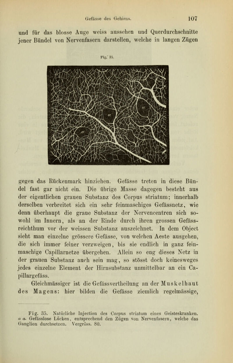 und für das blosse Auge weiss aussehen und Querdurchschnitte jener Bündel von Nervenfasern darstellen, welche in langen Zügen Fig.' 35. gegen das Rückenmark hinziehen. Gefässe treten in diese Bün- del fast gar nicht ein. Die übrige Masse dagegen besteht aus der eigentlichen grauen Substanz des Corpus striatum; innerhalb derselben verbreitet sich ein sehr feinmaschiges Gefässnetz, wie denn überhaupt die graue Substanz der Nervencentren sich so- wohl im Innern, als an der Rinde durch ihren grossen Gefäss- reichthum vor der weissen Substanz auszeichnet. In dem Object sieht man einzelne grössere Gefässe, von welchen Aeste ausgehen, die sich immer feiner verzweigen, bis sie endlich in ganz fein- maschige Capillarnetze übergehen. Allein so eng dieses Netz in der grauen Substanz auch sein mag, so stösst doch keinesweges jedes einzelne Element der Hirnsubstanz unmittelbar an ein Ca- pillargefäss. Gleiehmässiger ist die Gefässvertheilung an der Muskelhaut des Magens: hier bilden die Gefässe ziemlich regelmässige, Fig. 35. Natürliche Injection des Corpus striatum eines Geisteskranken. a a. Gefässlose Lücken, entsprechend den Zügen von Nervenfasern, welche das Ganglion durchsetzen. Vergröss. 80.