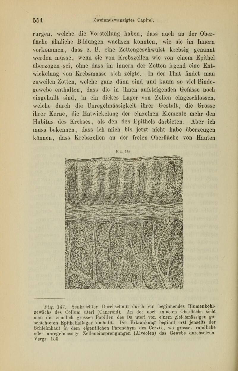 rurgen, welche die Vorstellung haben, dass auch an der Ober- fläche ähnliche Bildungen wachsen könnten, wie sie im Innern vorkommen, dass z. B. eine Zottengeschwulst krebsig genannt werden müsse, wenn sie von Krebszellen wie von einem Epithel überzogen sei, ohne dass im Innern der Zotten irgend eine Ent- wickelung von Krebsmasse sich zeigte. In der That findet man zuweilen Zotten, welche ganz dünn sind und kaum so viel Binde- gewebe enthalten, dass die in ihnen aufsteigenden Gefässe noch eingehüllt sind, in ein dickes Lager von Zellen eingeschlossen, welche durch die Unregelmässigkeit ihrer Gestalt, die Grösse ihrer Kerne, die Entwickelung der einzelnen Elemente mehr den Habitus des Krebses, als den des Epithels darbieten. Aber ich muss bekennen, dass ich mich bis jetzt nicht habe überzeugen können, dass Krebszellen an der freien Oberfläche von Häuten Fig. 147 Fig. 147. Senkrechter Durchschnitt durch ein beginnendes Blumenkohl- gewächs des Collum uteri (Cancroid). An der noch intacten Oberfläche sieht man die ziemlich grossen Papillen des Os uteri von einem gleichmässigen ge- schichteten Epitheliallager umhüllt. Die Erkrankung beginnt erst jenseits der Schleimhaut in dem eigentlichen Parenchym des Cervix, wo grosse, rundliche oder unregelmässige Zelleneinsprengungen (Alveolen) das Gewebe durchsetzen. Vergr. 150.