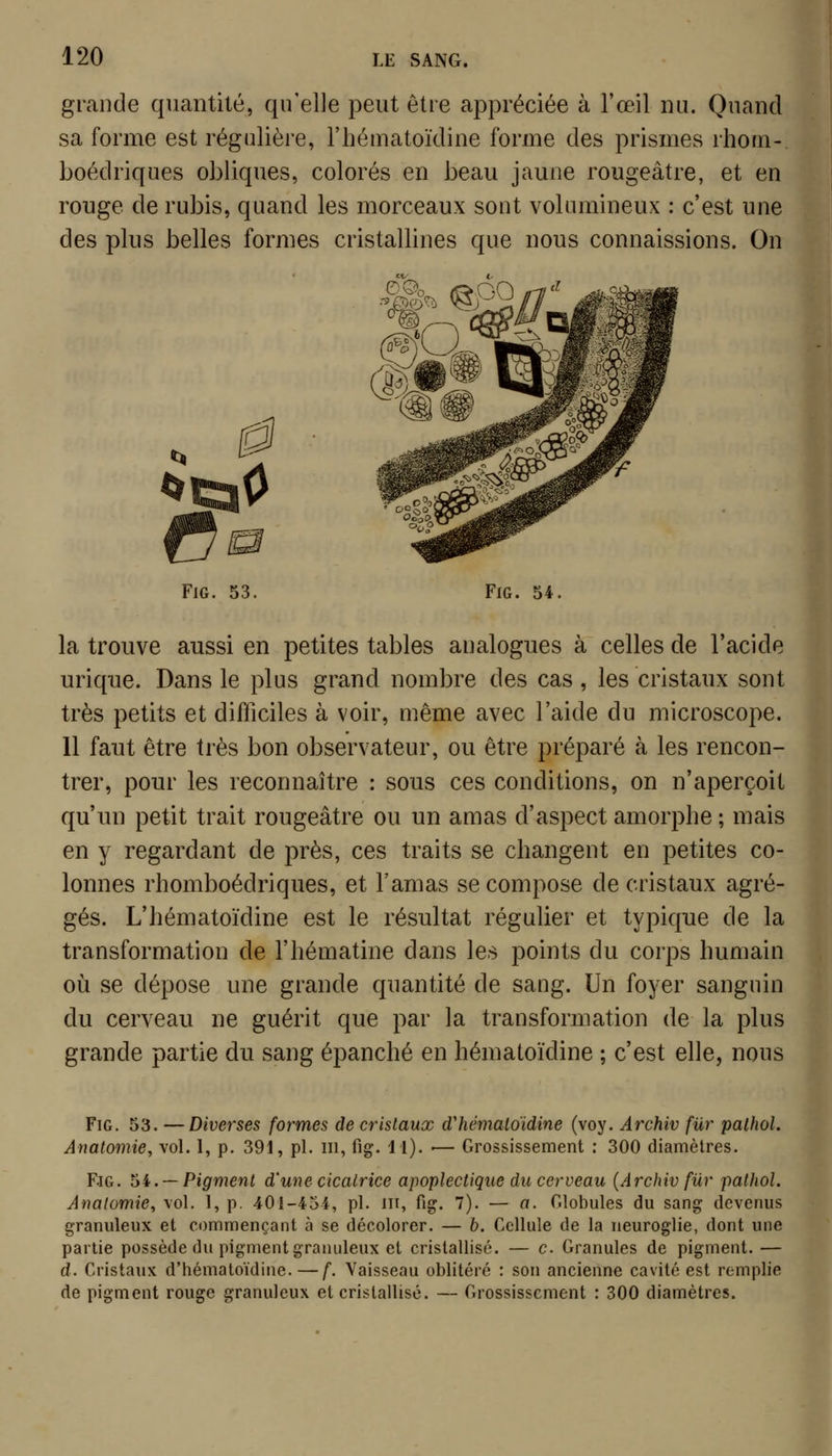 grande quantité, qu'elle peut être appréciée à l'œil nu. Quand sa forme est régulière, l'hématoïdine forme des prismes rhorn- boédriques obliques, colorés en beau jaune rougeâtre, et en rouge de rubis, quand les morceaux sont volumineux : c'est une des plus belles formes cristallines que nous connaissions. On FiG. 53. FlG. 54, la trouve aussi en petites tables analogues à celles de l'acide urique. Dans le plus grand nombre des cas , les cristaux sont très petits et difficiles à voir, même avec l'aide du microscope. 11 faut être très bon observateur, ou être préparé à les rencon- trer, pour les reconnaître : sous ces conditions, on n'aperçoit qu'un petit trait rougeâtre ou un amas d'aspect amorphe ; mais en y regardant de près, ces traits se changent en petites co- lonnes rhomboédriques, et l'amas se compose de cristaux agré- gés. L'hématoïdine est le résultat régulier et typique de la transformation de l'hématine dans les points du corps humain où se dépose une grande quantité de sang. Un foyer sanguin du cerveau ne guérit que par la transformation de la plus grande partie du sang épanché en hématoïdine ; c'est elle, nous FiG. 53. —Diverses formes de cristaux d'hémaloïdine (voy. Archiv fur palhol. Anatomie, vol. 1, p. 391, pi. m, fig. 11). — Grossissement : 300 diamètres. F.IG. ^i. — Pigment d'une cicatrice apoplectique du cerveau {Archiv fur pathol. Anatomie, vol. 1, p. 401-454, pi. in, fig. 7). — a. Globules du sang devenus granuleux et commençant à se décolorer. — b. Cellule de la neuroglie, dont une partie possède du pigment granuleux et cristallisé. — c Granules de pigment. — d. Cristaux d'hématoïdine.—f. Vaisseau oblitéré : son ancienne cavité est remplie de pigment rouge granuleux et cristallisé. — Grossissement : 300 diamètres.