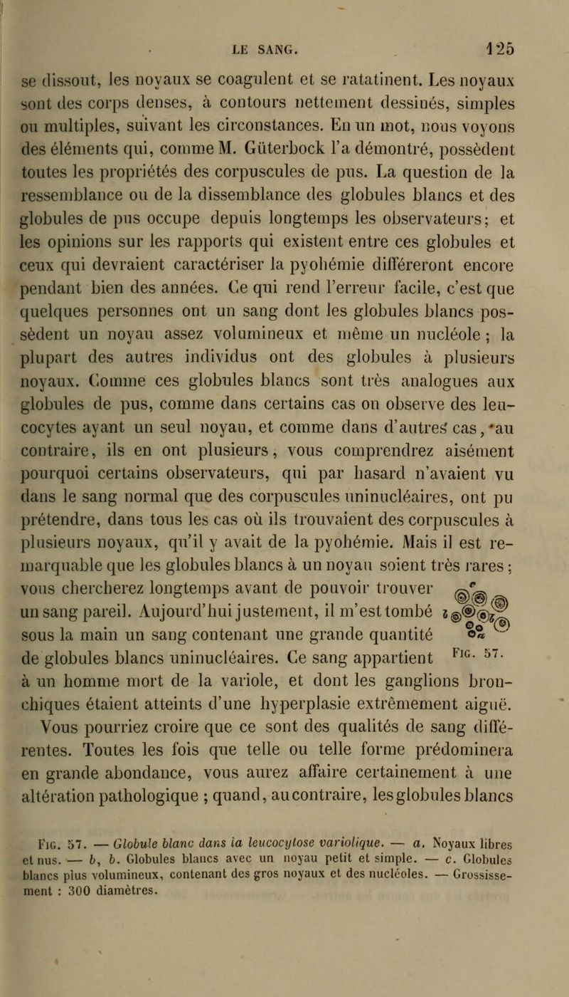 se dissout, les noyaux se coagulent et se ratatinent. Les noyaux sont des corps denses, à contours nettement dessinés, simples ou multiples, suivant les circonstances. En un mot, nous voyons des éléments qui, comme M. Gliterbock l'a démontré, possèdent toutes les propriétés des corpuscules de pus. La question de la ressemblance ou de la dissemblance des globules blancs et des globules de pus occupe depuis longtemps les observateurs; et les opinions sur les rapports qui existent entre ces globules et ceux qui devraient caractériser la pyoliémie difïereront encore pendant bien des années. Ce qui rend l'erreur facile, c'est que quelques personnes ont un sang dont les globules blancs pos- sèdent un noyau assez volumineux et même un nucléole ; la plupart des autres individus ont des globules à plusieurs noyaux, (^omme ces globules blancs sont très analogues aux globules de pus, comme dans certains cas on observe des leu- cocytes ayant un seul noyau, et comme dans d'autres' cas, 'au contraire, ils en ont plusieurs, vous comprendrez aisément pourquoi certains observateurs, qui par hasard n'avaient vu dans le sang normal que des corpuscules uninucléaires, ont pu prétendre, dans tous les cas où ils trouvaient des corpuscules à plusieurs noyaux, qu'il y avait de la pyohémie. Mais il est re- marquable que les globules blancs à un noyau soient très rares ; vous chercherez longtemps avant de pouvoir trouver ^^ un sang pareil. Aujourd'hui justement, il m'est tombé i@®é^^ sous la main un sang contenant une grande quantité o«  de globules blancs uninucléaires. Ce sang appartient ^^^' ^''^ à un homme mort de la variole, et dont les ganglions bron- chiques étaient atteints d'une hyperplasie extrêmement aiguë. Vous pourriez croire que ce sont des qualités de sang diffé- rentes. Toutes les fois que telle ou telle forme prédomineia en grande abondance, vous aurez affaire certainement à une altération pathologique ; quand, au contraire, les globules blancs piQ, 57. — Globule blanc dans la leucocytose variolique. — a. Noyaux libres et nus. — b, b. Globules blancs avec un noyau petit et simple. — c. Globules blancs plus volumineux, contenant des gros noyaux et des nucléoles. — Grossisse- ment : 300 diamètres.