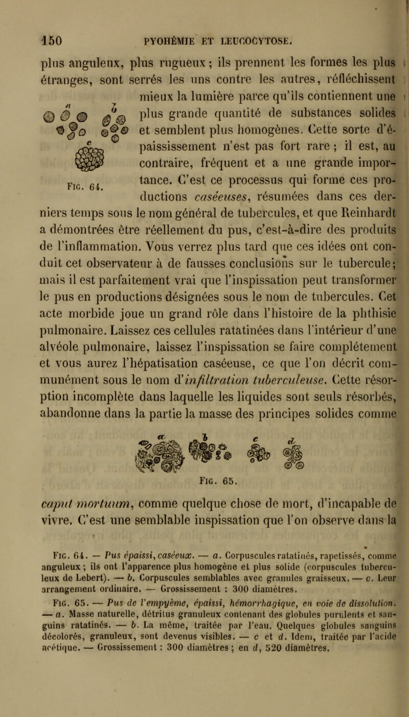 pins anguleux, pins rngueux ; ils prennent les formes les plus étranges, sont serrés les nns contre les autres, réfléchissent mieux la lumière parce qu'ils contiennent une © é # /^% P^^^ grande quantité de substances solides ^^Q @^a et semblent plus homogènes. Cette sorte d'é- paississement n'est pas fort rare ; il est, au contraire, fréquent et a une grande impor- P ^ tance. C'est ce processus qui forme ces pro- ductions caséeuses^ résumées dans ces der- niers temps sons le nom général de tubercules, et que Reinhardt a démontrées être réellement du pus, c'est-à-dire des produits de l'inflammation. Vous verrez plus tard que ces idées ont con- duit cet observateur à de fausses conclusions sur le tubercule; mais il est parfaitement vrai que l'inspissation peut transformer le pus en productions désignées sous le nom de tubercules. Cet acte morbide joue un grand rôle dans l'histoire de la phthisie pulmonaire. Laissez ces cellules ratatinées dans l'intérieur d'une alvéole pulmonaire, laissez l'inspissation se faire complètement et vous aurez l'hépatisation caséeuse, ce que l'on décrit com- munément sous le nom î^infiltration tuberculeuse. C^ette résor- ption incomplète dans laquelle les liquides sont seuls résorbés, abandonne dans la partie la masse des principes solides comme FiG. 65. capnt mortmim^ comme quelque chose de mort, d'incapable de vivre. C'est une semblable inspissation que l'on observe dans la FiG. 64. — Vus épaissi^ caséeux. — a. Corpuscules ratatines, rapetisses, comme anguleux ; ils ont l'apparence plus homogène et plus solide (corpuscules tubercu- leux de Lebert). — b. Corpuscules semblables avec granules graisseux. — c. Leur arrangement ordinaire. — Grossissement : 300 diamètres. FiG. 65. — Pus de l'empyème, épaissi, hémorrhagiqiie, en voie de dissolution. — a. Masse naturelle, détritus granuleux contenant des globules purulents et san- guins ratatinés. — 6. La même, traitée par l'eau. Quelques globules sanguins décolorés, granuleux, sont devenus visibles. — c et d. Idem, traitée par l'acide acétique. — Grossissement ; 300 diamètres ; en d, 520 diamètres,