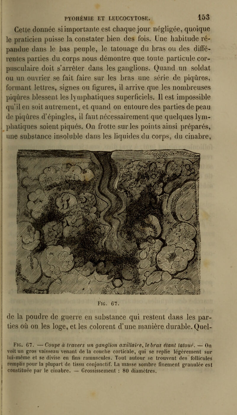 Cette donnée si importante est chaque jour négligée, quoique le praticien puisse la constater bien des fois. Une habitude ré- pandue dans le bas peuple, le tatouage du bras ou des diffé- rentes parties du corps nous démontre que toute particule cor- pusculaire doit s'arrêter dans les ganglions. Quand un soldat ou un ouvrier se fait faire sur les bras une série de piqûres, formant lettres, signes ou figures, il arrive que les nombreuses piqûres blessent les lymphatiques superficiels. Il est impossible qu'il en soit autrement, et quand on entoure des parties de peau de piqûres d'épingles, il faut nécessairement que quelques lym- ! phatiques soient piqués. On frotte sur les points ainsi préparés, i une substance insoluble dans les liquides du corps, du cinabre. FiG. 67. de la poudre de guerre en substance qui restent dans les par- ties où on les loge, et les colorent d'une manière durable. Quel- FiG. 67. —Coupe à travers un ganglion axillaîfe, lehras étant tatoue. — On voit un gros vaisseau venant de la couche corticale, qui se replie légèrement sur lui-même et se divise en fins ramusculcs. Tout autour se trouvent des follicules remplis pour la plupart de tissu conjonctif. La masse sombre finement granulée est constituée par le cinabre. — Grossissement : 80 diamètres.