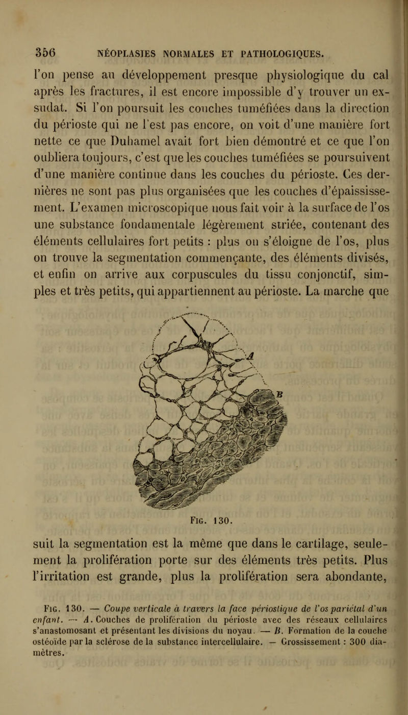 l'on pense au développement presque physiologique du cal après les fractures, il est encore impossible d'y trouver un ex- sudât. Si l'on poursuit les couches tuméfiées dans la direction du périoste qui ne l'est ])as encore, on voit d'une manière fort nette ce que Duhamel avait fort bien démontré et ce que l'on oubliera toujours, c'est que les couches tuméfiées se poursuivent d'une manière continue dans les couches du périoste. Ces der- nières ne sont pas plus organisées que les couches d'épaississe- ment. L'examen microscopique nous fait voir à la surface de l'os une substance fondamentale légèrement striée, contenant des éléments cellulaires fort petits : plus on s'éloigne de l'os, plus on trouve la segmentation commençante, des éléments divisés, et enfin on arrive aux corpuscules du tissu conjonctif, sim- ples et très petits, qui appartiennent au périoste. La marche que FiG. 130. suit la segmentation est la même que dans le cartilage, seule- ment la prolifération porte sur des éléments très petits. Plus l'irritation est grande, plus la prolifération sera abondante, FiG. 130. — Coupe verticale à travers la face périoslique de Vos pariétal d'un enfant. — /4. Couches de prolifôralion du périoste avec des réseaux cellulaires s'anastomosant et présentant les divisions du noyau. — Ji. Formation de la couche ostéoïde par la sclérose delà substance interceliulaire. — Grossissement: 300 dia- mètres.