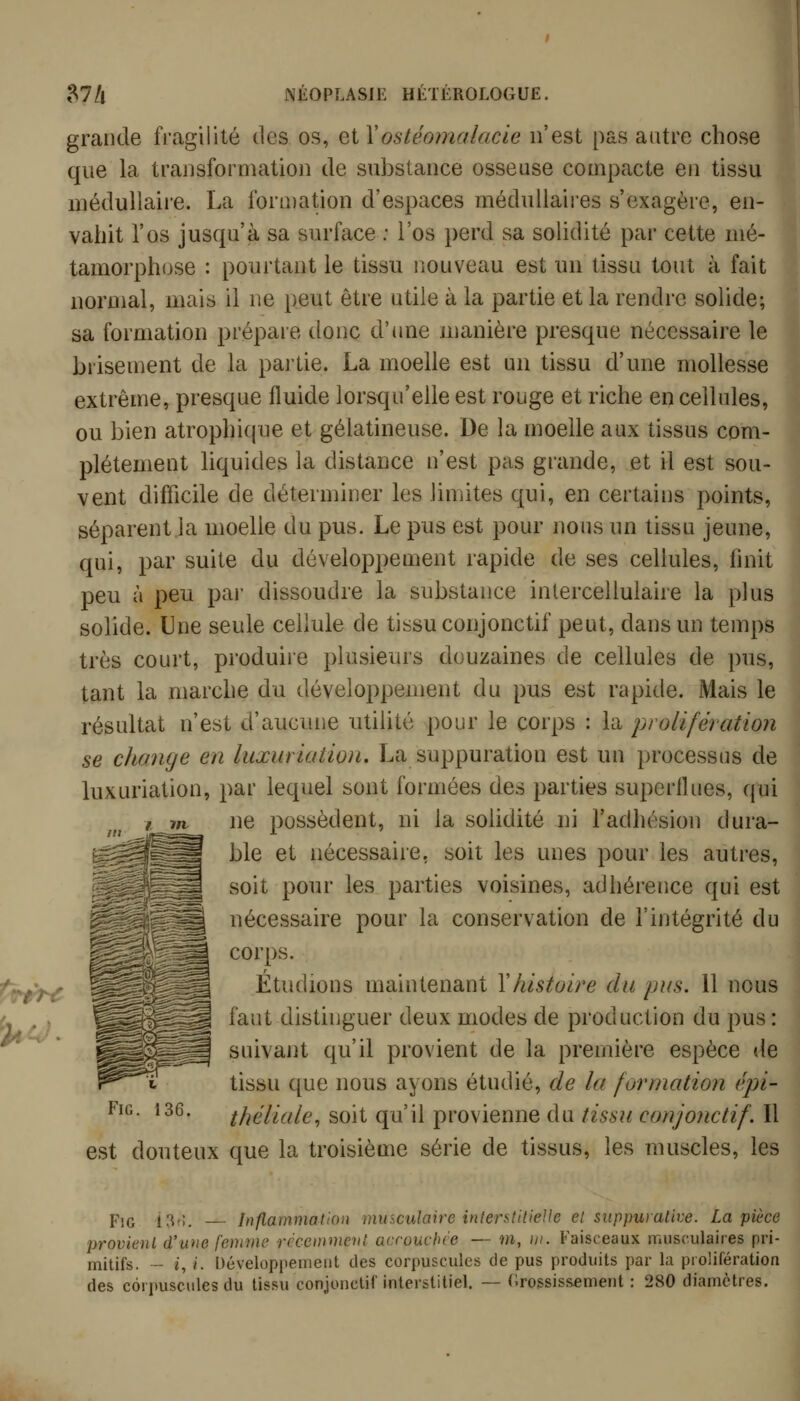 grande fi'agilité des os, eiVostéomaiacie n'est pas autre chose que la transformation de substance osseuse compacte en tissu médullaire. La formation d'espaces médullaires s'exagère, en- vahit l'os jusqu'à sa surface ; l'os perd sa solidité par cette mé- tamorphose : pourtant le tissu nouveau est un tissu tout à fait normal, mais il ne peut être utile à la partie et la rendre solide; sa formation prépare donc d'ime manière presque nécessaire le biisement de la partie. La moelle est un tissu d'une mollesse extrême, presque fluide lorsqu'elle est rouge et riche en cellules, ou bien atrophique et gélatineuse. De la moelle aux tissus com- plètement hquides la distance n'est pas grande, et il est sou- vent difficile de déterminer les limites qui, en certains points, séparent la moelle du pus. Le pus est pour nous un tissu jeune, qui, par suite du développement rapide de ses cellules, finit peu à peu par dissoudre la substance inlercellulaire la plus | solide. Une seule cellule de tissu conjonctif peut, dans un temps très court, produire plusieurs douzaines de cellules de pus, tant la marche du développement du pus est rapide. Mais le résultat n'est d'aucune utilité pour le corps : la prolifération se change en luxuriation. La suppuration est un processus de luxuriation, par lequel sont formées des parties superflues, qui ne possèdent, ni la solidité ni l'adhésion dura- ble et nécessaire, soit les unes pour les autres, soit pour les parties voisines, adhérence qui est nécessaire pour la conservation de l'intégrité du corps. Étudions maintenant Y histoire du pus. 11 nous faut distinguer deux modes de production du pus : suivant qu'il provient de la première espèce «le tissu que nous ayons étudié, de la formation épi- théliale, soit qu'il provienne du tissu conjonctif. Il est douteux que la troisième série de tissus, les muscles, les 13G. Pjg 13^;. — Inflammation musculaire interstitielle et suppurative. La pièce provient d'une femme récemment acrouchce — m, />/. Faisceaux musculaires pri- mitifs. - i, /. Développement des corpuscules de pus produits par la prolifération des corpuscules du tissu conjonctif interstitiel. — (Grossissement : 280 diamètres.