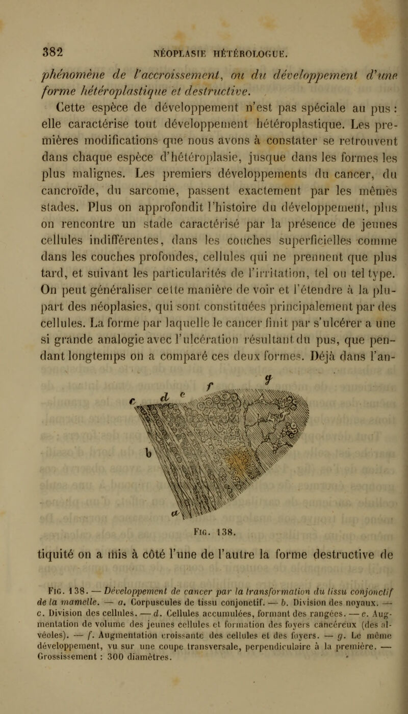 phénomène de l'accroissemcrit, cm du développemenl d^un forme hétéroplastique et destructive. Cette espèce cle développement n'est pas spéciale au pus / elle caractérise tout développement hétéroplastique. Les pre mières modifications que nous avons à constater se retrouvent dans chaque espèce d'hétéroplasie, jusque dans les formes les plus malignes. Les premiers développements du cancer, du cancroïde, du sarcome, passent exactement par les mêmes stades. Plus on approfondit l'histoire du développement, plus 1 on rencontre un stade caractérisé par la présence de jeunes cellules indifférentes, dans les couches superficielles comme dans les couches profondes, cellules qui ne prennent que plus tard, et suivant les particularités de l'ii-ritation, tel ou tel type. On peut généraliser celte manière de voir et l'étendre à la plu- part des néoplasies, qui sont constituées principalement par des cellules. La forme par laquelle le cancer finit par s'ulcérer a une si grande analogie avec l'ulcération résultant du pus, que pen- dant longtemps on a comparé ces deux forme?. Déjà dans fan- I I tiquité on a iHis à côté l'une de l'autre la forme destructive de FiG. 1 38. — Développemenl de cancer par la iransformatiun du lissu conjonctif de la mamelle. — a. Corpuscules de tissu conjonctif. — b. Division des noyaux. ^- c. Division des cellules. —d. Cellules accumulées, formant des rangées. —e. Aujj- mentation de volume des jeunes cellules et formation des foyers cancéreux (des <'il- véoles). — f. Augmentation croissante des cellules et des foyers. — g. Le môme développement, vu sur une coupe transversale, perpendiculaire à la première. — Grossissement : 300 diamètres.