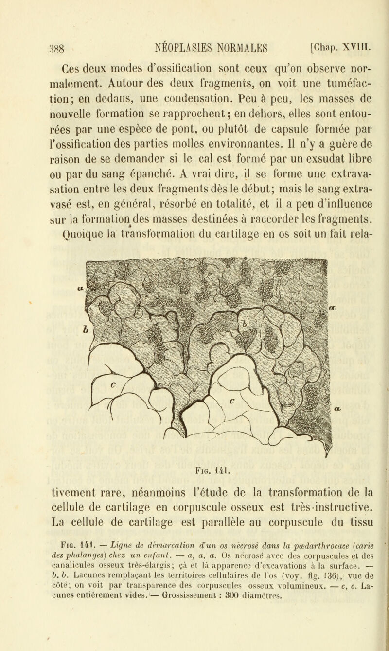 Ces deux modes d'ossification sont ceux qu'on observe nor- malement. Autour des deux fragments, on voit une tuméfac- tion; en dedans, une condensation. Peu à peu, les masses de nouvelle formation se rapprochent; en dehors, elles sont entou- rées par une espèce de pont, ou plutôt de capsule formée par l'ossification des parties molles environnantes. Il n'y a guère de raison de se demander si le cal est formé par un exsudât libre ou par du sang épanché. A vrai dire, il se forme une extrava- sation entre les deux fragments dès le début; mais le sang extra- vasé est, en général, résorbé en totalité, et il a peu d'influence sur la formation des masses destinées à raccorder les fragments. Quoique la transformation du cartilage en os soit un fait rela- Fig. 141. tivement rare, néanmoins l'étude de la transformation de la cellule de cartilage en corpuscule osseux est très instructive. La cellule de cartilage est parallèle au corpuscule du tissu Fig. 141. — Ligne de démarcation d'un os nécrosé dans la pœdarthrocace (carie des phalanges) chez un enfant. — a, a, a. Os nécrosé avec des corpuscules et des canalicules osseux très-élargis; çà et là apparence d'excavations à la surface. — b. b. Lacunes remplaçant les territoires cellulaires de l'os (voy. fig. 136), vue de côté; on voit par transparence des corpuscules osseux volumineux. —c, c. La- cunes entièrement vides. — Grossissement : 300 diamètres.