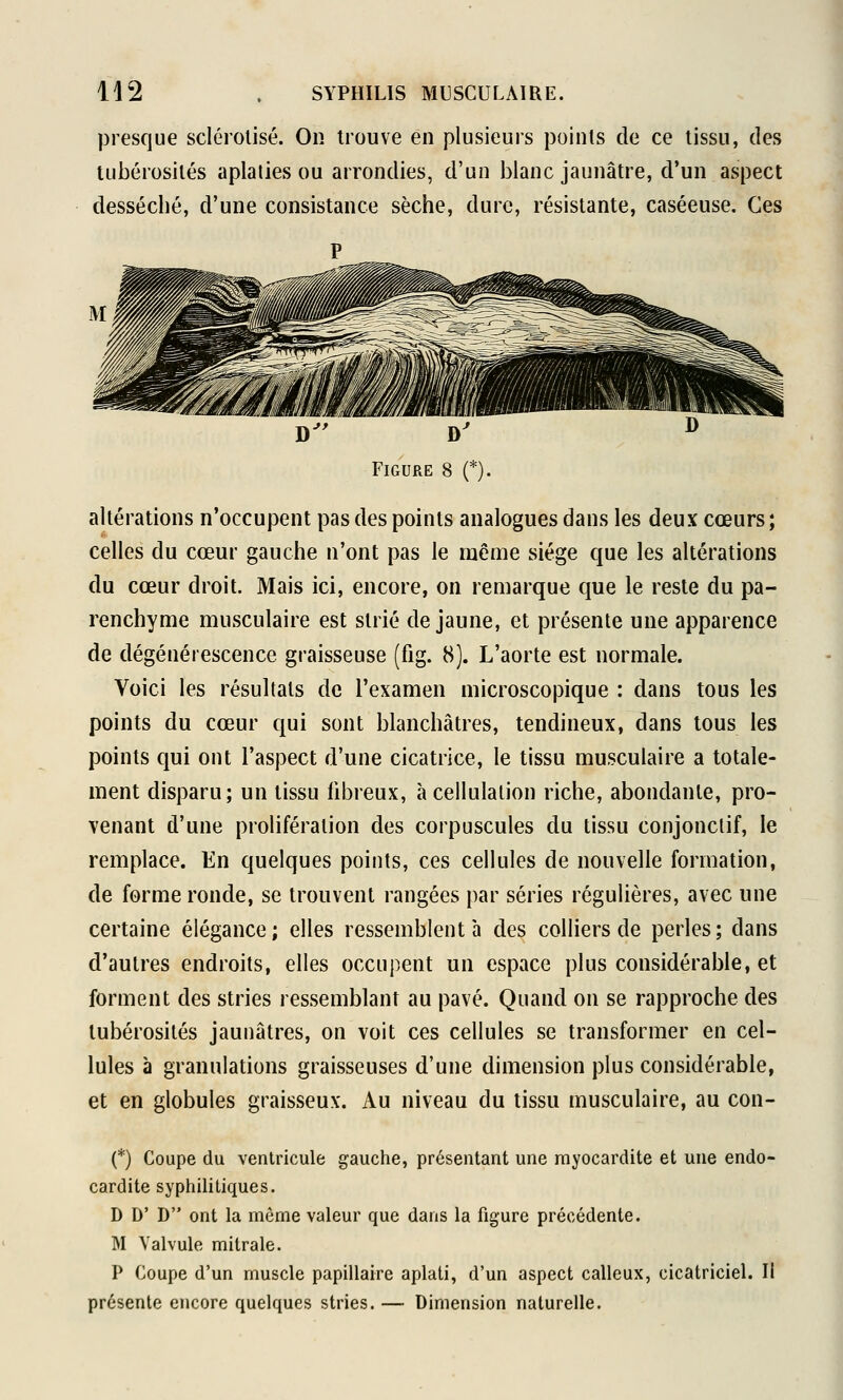 presque sclérolisé. On trouve en plusieurs points de ce tissu, des tubérosités aplaties ou arrondies, d'un blanc jaunâtre, d'un aspect desséché, d'une consistance sèche, dure, résistante, caséeuse. Ces altérations n'occupent pas des points analogues dans les deux cœurs ; celles du cœur gauche n'ont pas le même siège que les altérations du cœur droit. Mais ici, encore, on remarque cjue le reste du pa- renchyme musculaire est strié de jaune, et présente une apparence de dégénérescence graisseuse (fig. 8). L'aorte est normale. Voici les résultats de l'examen microscopique : dans tous les points du cœur qui sont blanchâtres, tendineux, dans tous les points qui ont l'aspect d'une cicatrice, le tissu musculaire a totale- ment disparu; un tissu fibreux, à cellulalion riche, abondante, pro- venant d'une prolifération des corpuscules du tissu conjonctif, le remplace. En quelques points, ces cellules de nouvelle formation, de forme ronde, se trouvent rangées par séries régulières, avec une certaine élégance; elles ressemblent à des colliers de perles; dans d'autres endroits, elles occupent un espace plus considérable, et forment des stries ressemblant au pavé. Quand on se rapproche des tubérosités jaunâtres, on voit ces cellules se transformer en cel- lules à granulations graisseuses d'une dimension plus considérable, et en globules graisseux. Au niveau du tissu musculaire, au con- (*) Coupe du ventricule gauche, présentant une rayocardite et une endo- cardite syphilitiques. D D' D ont la même valeur que dans la figure précédente. M Valvule mitrale. P Coupe d'un muscle papillaire aplati, d'un aspect calleux, cicatriciel. Il présente encore quelques stries. — Dimension naturelle.