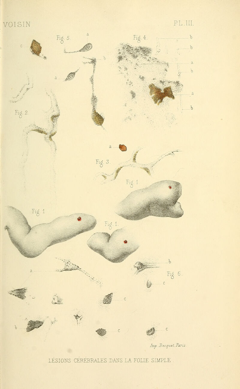 Ed. 5, -1) Fid. 4. PL.III. - — a Ed. 2. Pid. 3. '% '%■' ;# Ed. 1. -^■li^^ r..gi n^i Ed. 6 Tf- Iirrp .^ecqaet.rsris.