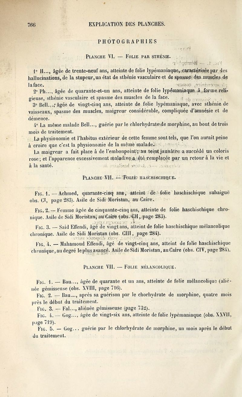 766 EXPLICATION DES PLANCHES. PHOTOGRAPHIES Planche VI. — Folie par sthénie. %'■ fyp?raèH — 1° H..., âgée de trente-neuf ans, atteinte de folie lypémaniaqtta,rcatfa£l6,flisée!par des hallucinations, de la stupeur, un état de sthénie vasculaire et de s%®m&\ des muscles de laface. ' 'HfiftiQ? jmfib ■'< ■- 2° Ph..., âgée de quarante-et-un ans, atteinte de folie lypémanijaque; à^forme reli- gieuse, sthénie vasculaire et spasme des muscles de la face. : i( ,;ri,_;,;.- „ , 3° Bell...,* âgée de vingt-cinq ans, atteinte de folie lypémaniaque, avec sthénie de vaisseaux, spasme des muscles, maigreur considérable, compliquée d'âimnésie et île démence. 4°. La même malade Bell..., guérie par le chlorhydrate^de morphine, au bout de trois mois de traitement. La physionomie et l'habitus extérieur de cette femme sont tels, que l'on aurait peine à croire que c'est la physionomie de la mèmemaladeJ ' nru f La maigreur a fait place à de l'embonpoint^taMteipt jaunâtre a succédé un coloris rose; et l'apparence excessivement i^a.lâdiv^!1été'i'emplaç,ée ïpar un retour à la vie et à la santé. ^fj p'usfefid tyiâWh -^—: ;^-w»'sA Planche VII. 'ÉiMtomfa HAscHîsoHmuE.' .■■■ Fig. 1. — Achmed, quarante-cinq' ans, a«tehit:dé-1 folie haschischique subaiguë obs. CI, page 283). Asile de Sidi Moristan, au Caire. Fig, 2.— Femme âgée de cinquante-cinq ans, atteinte de folie haschischique chro- nique. Asile de Sidi Moristai^aiVCaire '(obs.'CM, page 283). p1G# 3, — Said Effendi, âgé de vingt ans, atteint de folie haschischique mélancolique chronique. Asile de Sidi Moristan (obs. CIII, page 284). !.;>v.!jyrg sàsoqgiis ïfjpy /. vr^y^,;--. ■.. FlG. 4. — Mahamoud Effendi, âgé de vingt-cinq ans, atteint de folie haschischique chronique, au degré leplusavancé. Asile de Sidi Moristan, au Caire (obs. CIV, page 284). Planche VII. —Folie mélancolique. Fig. 4. — Bau..,, âgée de quarante et un ans, atteinte de folie mélancolique (alié- née gémisseuse (obs. XVIII, page 716). pIG 2. — Bau..., après sa guérison par le chorhydrate de morphine, quatre mois près le début du traitement. Fig. 3. — Fal..., aliénée gémisseuse (page 732). Fig. 4. — Cog..., âgée de vingt-six ans, atteinte de folie lypémaniaque (obs. XXVII, page 719). FlG. 5. — Gog... guérie par le chlorhydrate de morphine, un mois après le début du traitement.