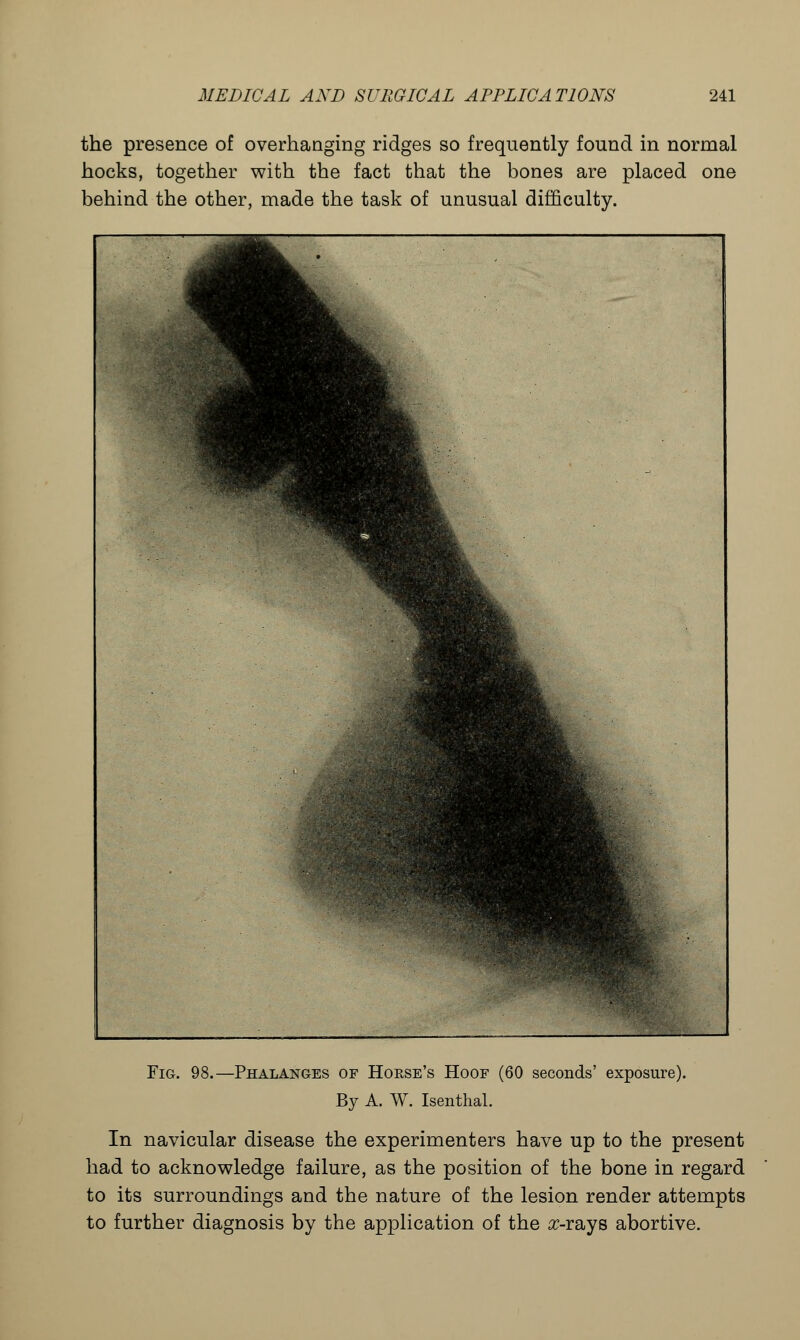 the presence of overhanging ridges so frequently found in normal hocks, together with the fact that the bones are placed one behind the other, made the task of unusual difficulty. Fig. 98.—Phalanges of Horse's Hoof (60 seconds' exposure). By A. W. Isenthal. In navicular disease the experimenters have up to the present had to acknowledge failure, as the position of the bone in regard to its surroundings and the nature of the lesion render attempts to further diagnosis by the application of the #-rays abortive.