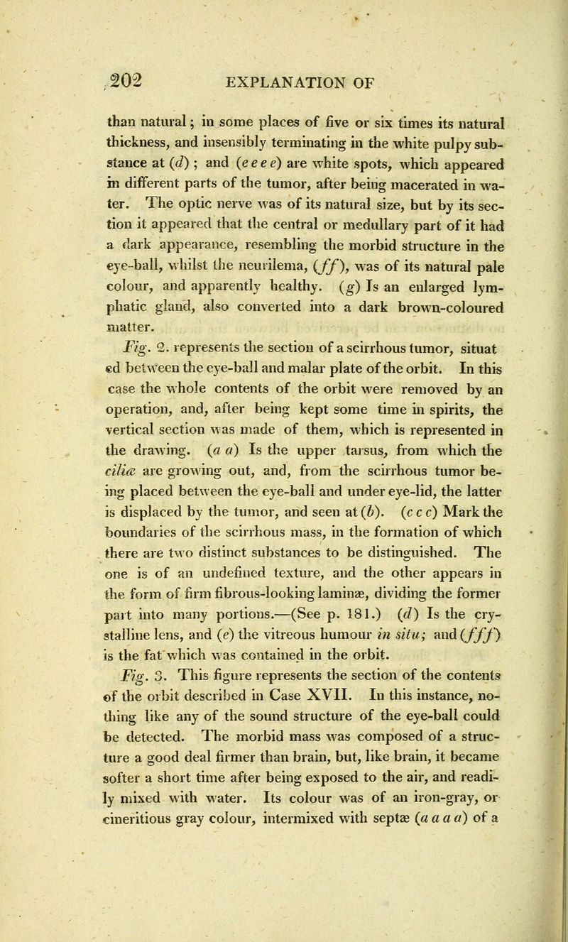 than natural; in some places of five or six times its natural thickness, and insensibly terminating in the white pulpy sub- stance at (d) ; and (eeee) are white spots, which appeared in different parts of the tumor, after being macerated in wa- ter. The optic nerve was of its natural size, but by its sec- tion it appeared that the central or medullary part of it had a dark appearance, resembling the morbid structure in the eye-ball, whilst the neurilema, {ff), was of its natural pale colour, and apparently healthy, (g) Is an enlarged lym- phatic gland, also converted into a dark brown-coloured matter. Fig. 2. represents the section of a scirrhous tumor, situat ed between the eye-ball and malar plate of the orbit. In this case the whole contents of the orbit were removed by an operation, and, after being kept some time in spirits, the vertical section was made of them, which is represented in the drawing, (a a) Is the upper tarsus, from which the cilia are growing out, and, from the scirrhous tumor be- ing placed between the eye-ball and under eye-lid, the latter is displaced by the tumor, arid seen at (b). (c c c) Mark the boundaries of the scirrhous mass, in the formation of which there are two distinct substances to be distinguished. The one is of an undefined texture, and the other appears in the form of firm fibrous-looking laminae, dividing the former part into many portions.—(See p. 181.) (d) Is the cry- stalline lens, and (e) the vitreous humour in situ; m\d.(J'ff) is the fat which was contained in the orbit. Fig. 3. This figure represents the section of the contents ©f the orbit described in Case XVII. In this instance, no- thing like any of the sound structure of the eye-ball could be detected. The morbid mass was composed of a struc- ture a good deal firmer than brain, but, like brain, it became softer a short time after being exposed to the air, and readi- ly mixed with water. Its colour was of an iron-gray, or cineritious gray colour, intermixed with septae (a a a a) of a