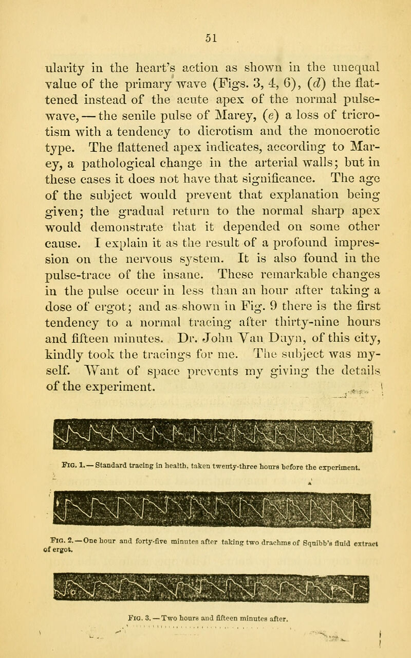 ularity in the heart's action as shown in the unequal value of the primary wave (Figs. 3, 4, 6), (d) the flat- tened instead of the acute apex of the normal pulse- wave, — the senile pulse of Marey, (e) a loss of tricro- tism with a tendency to dicrotism and the monocrotic type. The flattened apex indicates, according to Mar- ey, a pathoU)gical change in the arterial walls; but in these cases it does not have that significance. The age of the subject would prevent that explanation being given; the gradual return to the normal sharp apex would demonstrate that it depended on some other cause. I explain it as the result of a profound impres- sion on the nervous system. It is also found in the pulse-trace of the insane. These remarkable changes in the pulse occur in less than an hour after taking a dose of ergot; and as shown in Fig. 9 there is the first tendency to a normal tracing after thirty-nine hours and fifteen minutes. Dr. John Yan Duyn, of this city, kindly took the tracings for me. The subject was my- self. Tfant of space prevents my giving the details of the experiment. ,.*f.v \ Fig. 1.— Standard tracing in health, taken twenty-three honrs before the experiment. T^O. 2.—Onehour and forty-five minntes after taking two drachms of Squibb's fluid extract of ergot. Fig. 3. — Two hours and fifteen minutes after.