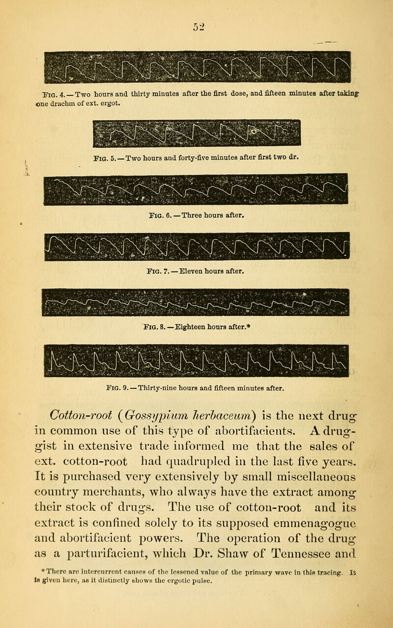 I^G. 4. Two hours and thirty minutes after the first dose, and fifteen minutes after taMnj one drachm of ext. ergot. Fig. 5.—Two hours and forty-five minutes after first two dr. Pig. 6.—Three hours after. Fig. 7. —Eleven hours after. Fig. 8. —Eighteen hours after.* Fig. 9.—Thirty-nine hours and fifteen minutes after. Cotton-root (^Gossypium lierbaceum) is the next drug^ in common use of this type of abortifacients. A drug- gist in extensive trade informed me that the sales of ext. cotton-root had quadrupled in the last five years. It is purchased very extensively by small miscellaneous country merchants, who always have the extract among- their stock of drugs. The use of cotton-root and its extract is confined solely to its supposed emmenagogue and abortifacient powers. The operation of the drug as a parturifacient, which Dr. Shaw of Tennessee and * There are intercurrent causes of the lessened value of the primary wave in this tracing. 14 Is given here, as it distinctly BhowB the crgolic pulse.