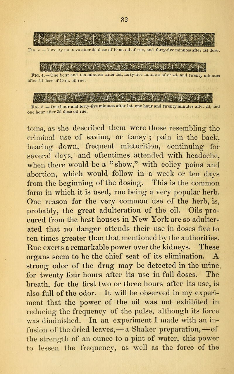 Fig. o. — Tvveuty minutes alter 2d dose of 10 m. oil of rue, and forty-five minutes after 1st dose. Fig. 4.—One hour and ten minutes after itit, forty-nve uuuuies after 2(i, and twenty minutes after 3d dose of 10 m. oil rue. Fig. 5. — One hour and forty-five minutes after 1st, one hour and twenty minutes after 2d, and one hour after 3d dose oil rue. toms, as she described them were those resemblmg the criminal nse of savine, or tansy ; pain in the back, bearing down, frequent micturition, continuing for several days, and oftentimes attended with headache, when there would be a  show, with colicy pains and abortion, which would follow in a week or ten days from the beginning of the dosing. Tliis is the common form in which it is used, rue being a very popular herb. One reason for the very common use of the herb, is, probably, the great adulteration of the oil. Oils pro- cured from the best houses in l^ew York are so adulter- ated that no danger attends their use in doses five to ten times greater than that mentioned by the authorities. Rue exerts a remarkable power over the kidneys. These organs seem to be the chief seat of its elimination. A strong odor of the drug may be detected in the urine, for twenty four hours after its use in full doses. The breath, for the first two or three hours after its use, is also full of the odor. It will be observed in my experi- ment that the power of the oil was not exhibited in reducing the frequency of the pulse, although its force was diminished. In an experiment I made with an in- fusion of the dried leaves,^—a Shaker preparation,—of the strength of an ounce to a pint of water, this power to lessen the frequency, as well as the force of the
