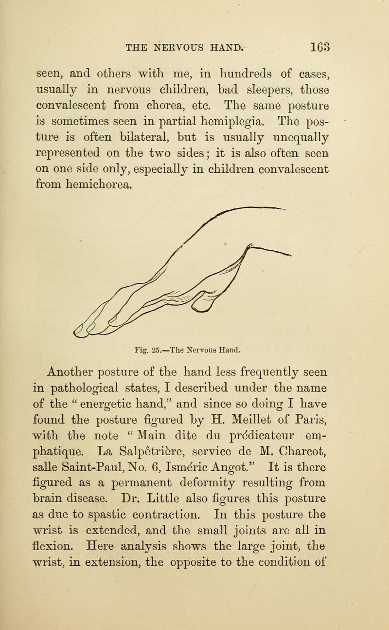 seen, and others with me, in hundreds of cases, usually in nervous children, bad sleepers, those convalescent from chorea, etc. The same posture is sometimes seen in partial hemiplegia. The pos- ture is often bilateral, but is usually unequally represented on the two sides; it is also often seen on one side only, especially in children convalescent from hemichorea. Fig. 25.—The Nervous Hand. Another posture of the hand less frequently seen in pathological states, I described under the name of the  energetic hand, and since so doing I have found the posture figured by H. Meillet of Paris, with the note  Main dite du predicateur em- phatique. La Salpetriere, service de M. Charcot, salle Saint-Paul, No. 6, Ismeric Angot. It is there figured as a permanent deformity resulting from brain disease. Dr. Little also figures this posture as due to spastic contraction. In this posture the wrist is extended, and the small joints are all in flexion. Here analysis shows the large joint, the wrist, in extension, the opposite to the condition of