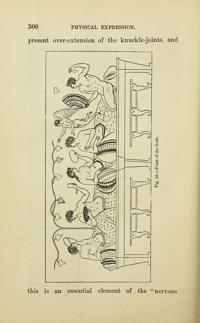 present over-extension of the knuckle-joints, and this is an essential element of the ''nervous