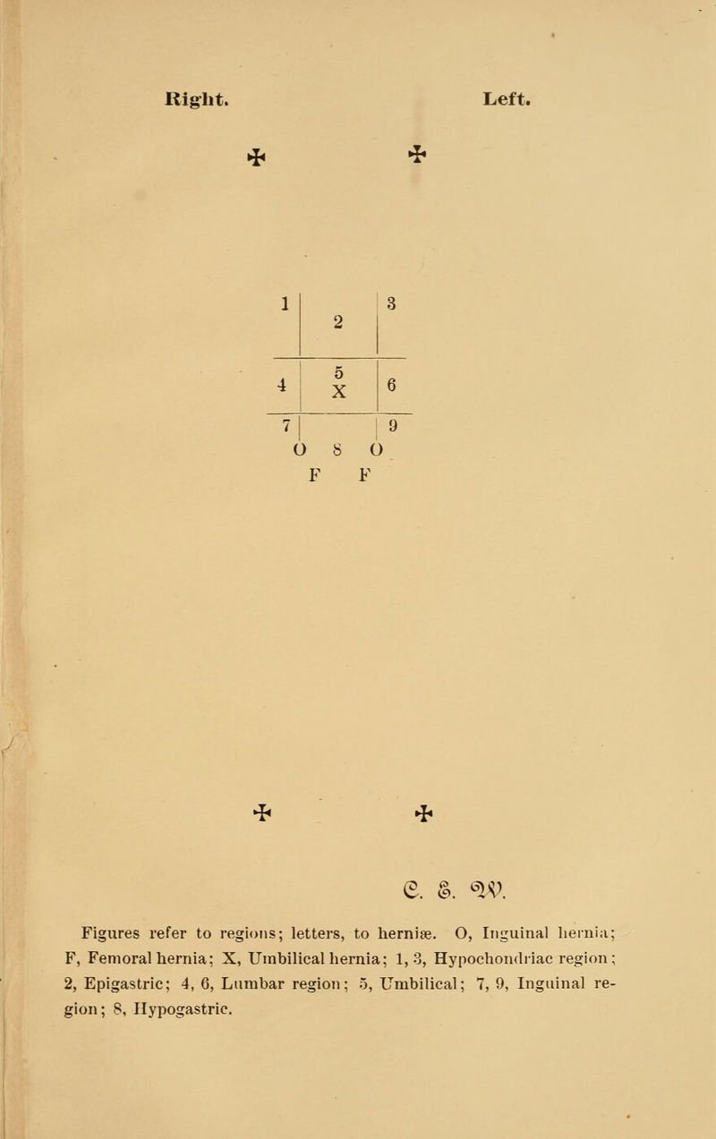 Right. Left. 1 2 3 5 4 X 6 7| |9 O 8 O F F e. ^. ^'^. Figures refer to regions; letters, to hernise. O, Inguinal hernia; F, Femoral hernia; X, Umbilical hernia; 1,3, Hypochondriac region; 2, Epigastric; 4, 6, Lumbar region; 5, Umbilical; 7, 9, Inguinal re- gion; 8, Hypogastric.