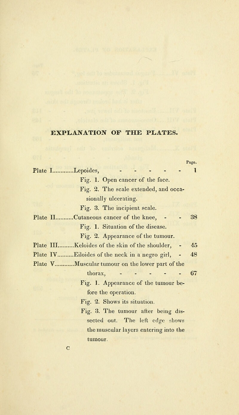 EXPLANATION OF THE PLATES. Page. Plate I Lepoides, ----- \ Fig. 1. Open cancer of the face. Fig. 2. The scale extended, and occa- sionally ulcerating. Fig. 3. The incipient scale. Plate II Cutaneous cancer of the knee, - - 38 Fig. 1. Situation of the disease. Fig. 2. Appearance of the tumour. Plate III Keloides of the skin of the shoulder, - 45 Plate IV Eiloides of the neck in a negro girl, - 48 Plate V Muscular tumour on the lower part of the thorax, ----- 67 Fig. 1. Appearance of the tumour be- fore the operation. Fig. 2. Shows its situation. Fig. 3. The tumour after being dis- sected out. The left edge shows the muscular layers entering into the tumour. c