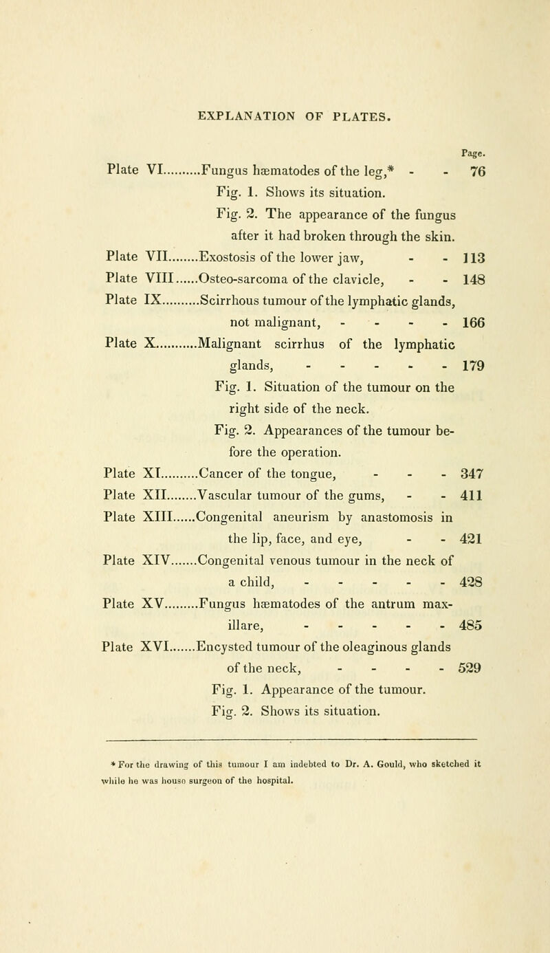 Page. Plate VI Fungus haematodes of the leg,* - - 76 Fig. 1. Shows its situation. Fig. 2. The appearance of the fungus after it had broken through the skin. Plate VII Exostosis of the lower jaw, - - 113 Plate VIII Osteo-sarcoma of the clavicle, - - 148 Plate IX Scirrhous tumour of the lymphatic glands, not malignant, - - - - 166 Plate X Malignant scirrhus of the lymphatic glands, 179 Fig. 1. Situation of the tumour on the right side of the neck. Fig. 2. Appearances of the tumour be- fore the operation. Plate XT Cancer of the tongue, - - . 347 Plate XII Vascular tumour of the gums, - - 411 Plate XIII Congenital aneurism by anastomosis in the lip, face, and eye, - - 421 Plate XIV Congenital venous tumour in the neck of a child, 428 Plate XV Fungus haematodes of the antrum max- illare, 485 Plate XVI Encysted tumour of the oleaginous glands of the neck, - _ . - 539 Fig. 1. Appearance of the tumour. Fiof. 2. Shows its situation. * For the drawing of this tumour I am indebted to Dr. A. Gouhl, who sketched it wliilo ho was housn surgnon of the hospital.