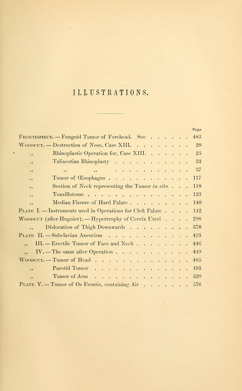 ILLUSTRATIONS. Page Frontispiece. — Fungoid Tumor of Forehead. See 483 Woodcut. — Destruction of Nose, Case XIII 20 Rhinoplastic Operation for, Case XIII 25 Taliacotian Rhinoplasty 33 • • 37 Tumor of (Esophagus 117 Section of Neck representing the Tumor in situ . . . 118 Tonsillotome 123 Median Fissure of Hard Palate 140 Plate I. — Instruments used in Operations for Cleft Palate .... 142 Woodcut (after Huguier). — Hypertrophy of Cervix Uteri .... 298 ,, Dislocation of Thigh Downwards 378 Plate II. — Subclavian Aneurism 425 ,, III. — Erectile Tumor of Face and Neck 446 ,, IV. — The same after Operation 449 Woodcut. — Tumor of Head 485 ,, Parotid Tumor 495 ,, Tumor of Arm 520 Plate V. — Tumor of Os Frontis, containing Air 576