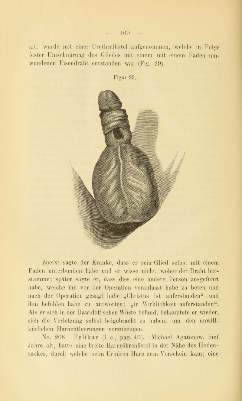 alt, wurde mit einer Urethralfiste] aufgenommen, welche in Folge fester Umschnürung des Gliedes mit einem mit einem Faden um- wundenen Eisendraht entstanden war (Fig. 29). Figur 29. Zuerst sagte der Kranke, dass er sein Glied selbst mit einem Faden unterbunden habe und er wisse nicht, woher der Draht her- stamme; später sagte er, dass dies eine andere Person ausgeführt habe, welche ihn vor der Operation veranlasst habe zu beten und nach der Operation gesagt habe „Christus ist auferstanden und ihm befohlen habe zu antworten: „in Wirklichkeit auferstanden. Als er sich in der Dawidoff sehen Wüste befand, behauptete er wieder, sich die Verletzung selbst beigebracht zu haben, um den unwill- kürlichen Harnentleerungen vorzubeugen. No. 208. Pelikan (1. c, pag. 40). Michael Agatonow, fünf Jahre alt, hatte eine breite Harnröhrenfistel in der Nähe des Hoden- sackes, durch welche beim Uriniren Harn zum Vorschein kam; eine