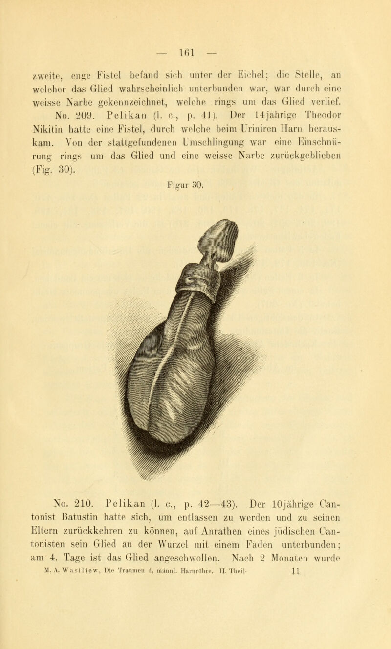 zweite, enge Fistel befand sich unter der Eichel; die Stelle, an welcher das Glied wahrscheinlich unterbunden war, war durch eine weisse Narbe gekennzeichnet, welche rings um das Glied verlief. No. 209. Pelikan (1. c, p. 41). Der 14jährige Theodor Nikitin hatte eine Fistel, durch welche beim Uriniren Harn heraus- kam. Von der stattgefundenen Umschlingung war eine Einschnü- rung rings um das Glied und eine weisse Narbe zurückgeblieben (Fig. 30). Figur 30. No. 210. Pelikan (1. c, p. 42—43). Der 10jährige Can- tonist Batustin hatte sich, um entlassen zu werden und zu seinen Eltern zurückkehren zu können, auf Anrathen eines jüdischen Can- tonisten sein Glied an der Wurzel mit einem Faden unterbunden: am 4. Tage ist das Glied angeschwollen. Nach 2 Monaten wurde M. A. W asiliew, Die Traumen d, mann]. Harnröhre. FI. Tlieil- 11