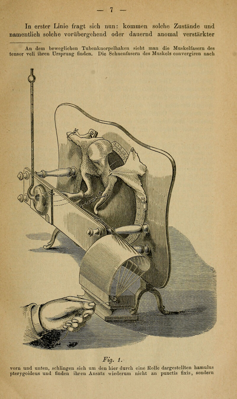 In erster Linie fragt sich nun: kommen solche Zustände und namentlich solche vorübergehend oder dauernd anomal verstärkter An dem beweglichen Tubenknorpelhaken sieht man die Muskelfasern des tensor veli ihren Ursprung finden. Die Sehnenfasern des Muskels convergiren nach Fig. 1. vorn und unten, schlingen sich um den hier durch eine Rolle dargestellten hamulus pterygoideus und finden ihren Ansatz wiederum nicht an punctis fixis, sondern