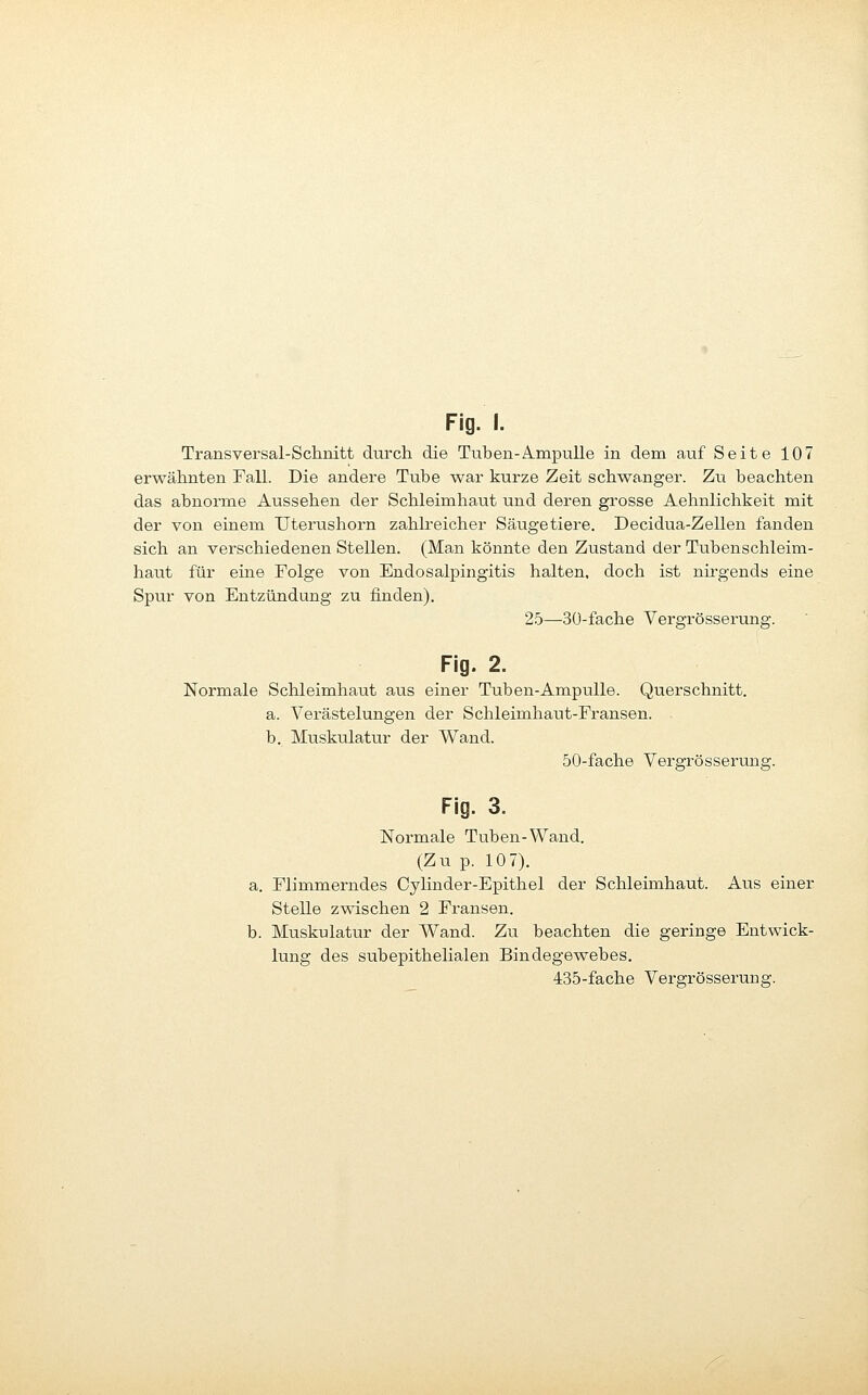 Transversal-Sclinitt durch die Tuben-Ampulle in dem auf Seite 107 erwähnten Fall. Die andere Tube war kurze Zeit schwanger. Zu beachten das abnorme Aussehen der Schleimhaut und deren grosse Aehnlichkeit mit der von einem Uterushorn zahlreicher Säugetiere. Decidua-Zellen fanden sich an verschiedenen Stellen. (Man könnte den Zustand der Tubenschleim- haut für eine Folge von Endosalpingitis halten, doch ist nirgends eine Spur von Entzündung zu finden). 25—3ü-fache Vergrösserung. Fig. 2. Normale Schleimhaut aus einer Tuben-Ampulle. Querschnitt. a. Verästelungen der Schleimhaut-Fransen. b. Muskulatur der Wand. 50-fache Vergrösserung. Fig. 3. Normale Tuben-Wand. (Zu p. 107). a. Flimmerndes Cylinder-Epithel der Schleimhaut. Aus einer Stelle zwischen 2 Fransen. b. Muskulatur der Wand. Zu beachten die geringe Entwick- lung des subepithelialen Bindegewebes.