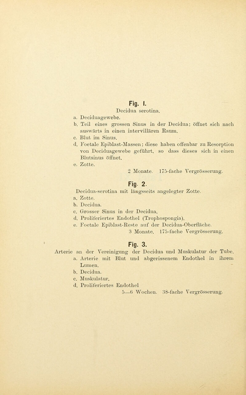 Decidua serotina. a. Deciduagewebe. b. Teil eines grossen Sinus in der Decidua; öffnet sich nach auswärts in einen intervillären Raum. c. Blut im Sinus. d. Toetale Epiblast-Massen; diese haben offenbar zu Resorption von Deciduagewebe geführt, so dass dieses sich in einen Blutsinus öffnet. e. Zotte. 2 Monate. 175-fache Vergrösserung. Fig. 2. Decidua-serotina mit längsseits angelegter Zotte. a. Zotte. b. Decidua. c. Grosser Sinus in der Decidua. d. Proliferiertes Endothel (Trophospongia). e. Foetale Epiblast-Reste aiif der Decidua-Oberfläche. 3 Monate. 175-fache Vergrösserung. Fig. 3. Arterie an der Vereinigung der Decidua und Muskulatur der Tube. a. Arterie mit Blut und abgerissenem Endothel in ihrem Lumen. b. Decidua. c. Muskulatur. d. Proliferiertes Endothel 5—6 Wochen. 38-fache Vergrösserung.