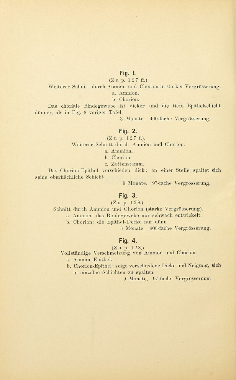 Fig. !. (Z u p. 1 2 7 ff.) Weiterer Schnitt durch Aranion und Chorion in starker Vergrösserung. a. Amnion. b. Chorion. Das choriale Bindegewebe ist dicker dünner, als in Fig. 3 voriger TafeL 3 Monate. und die tiefe Epithelschicht 400-fache Vergrösserung. Fig. 2. (Zu p. 127 f.). Weiterer Schnitt durch Amnion und Chorion. • a. Ammion. b. Chorion. c. Zottenstamm. Das Chorion-Epithel verschieden dick; an einer Stelle spaltet sich seine oberflächliche Schicht. 9 Monate. 97-fache Vergrösserung. Fig. 3. (Zu p. 12 8.) Schnitt durch Ammion und Chorion (starke Vergrösserung). a. Amnion; das Bindegewebe nur schwach entwickelt. b. Chorion; die Epithel-Decke nur dünn. 3 Monate. 400-fache Vergrösserung. Fig. 4. (Zu p. 12 8.) Vollständige Verschmelzung von Amnion und Chorion. a. Amnion-Epithel. b. Chorion-Epithel; zeigt verschiedene Dicke und Neigung, sich in einzelne Schichten zu spalten.